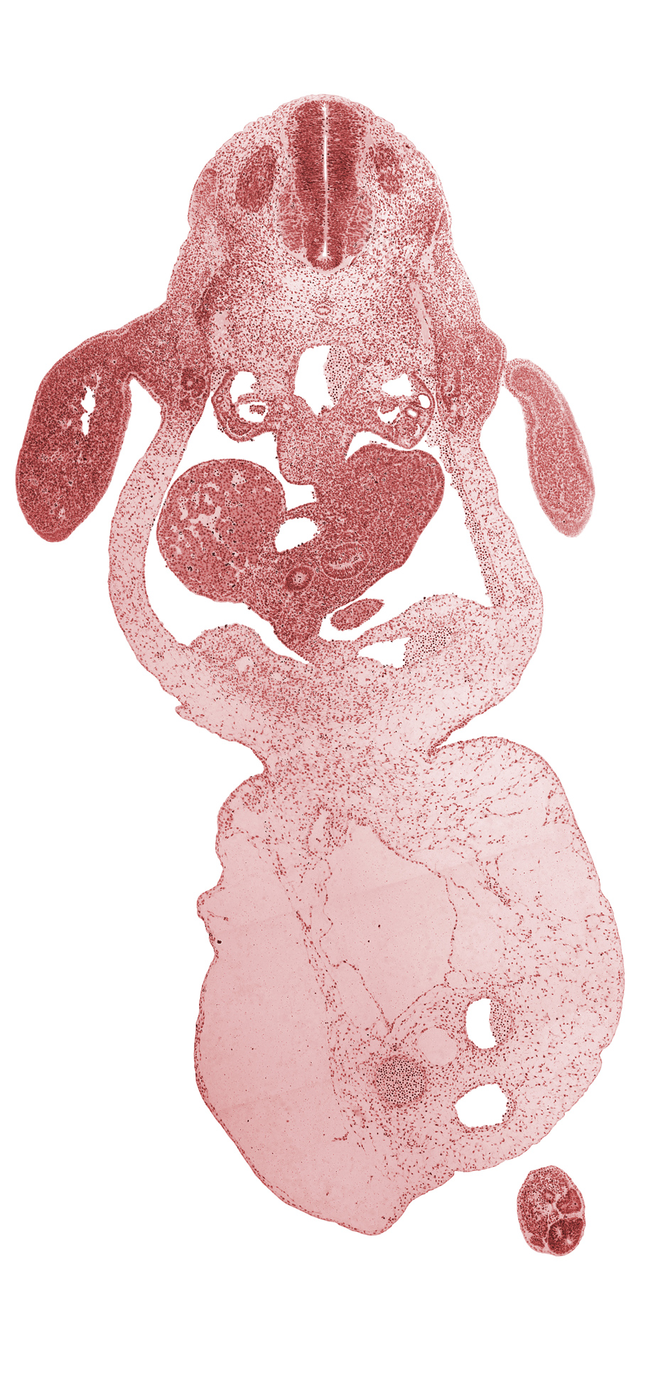 C-8 spinal ganglion, allantois, aorta, caudal edge of left lobe of liver, caudal eminence, coccygeal somites, common umbilical vein, dermatome, dorsal mesogastrium, duodenum, epiploic foramen, involuting right umbilical vein, junction of bile duct and hepatic ducts, left umbilical artery, left umbilical vein, lesser  sac, myotome, neural tube, notochord, omphalomesenteric (superior mesenteric) vein, post anal gut, right lobe of liver, right umbilical artery, sclerotome, septum transversum, umbilical coelom, umbilical cord, upper limb