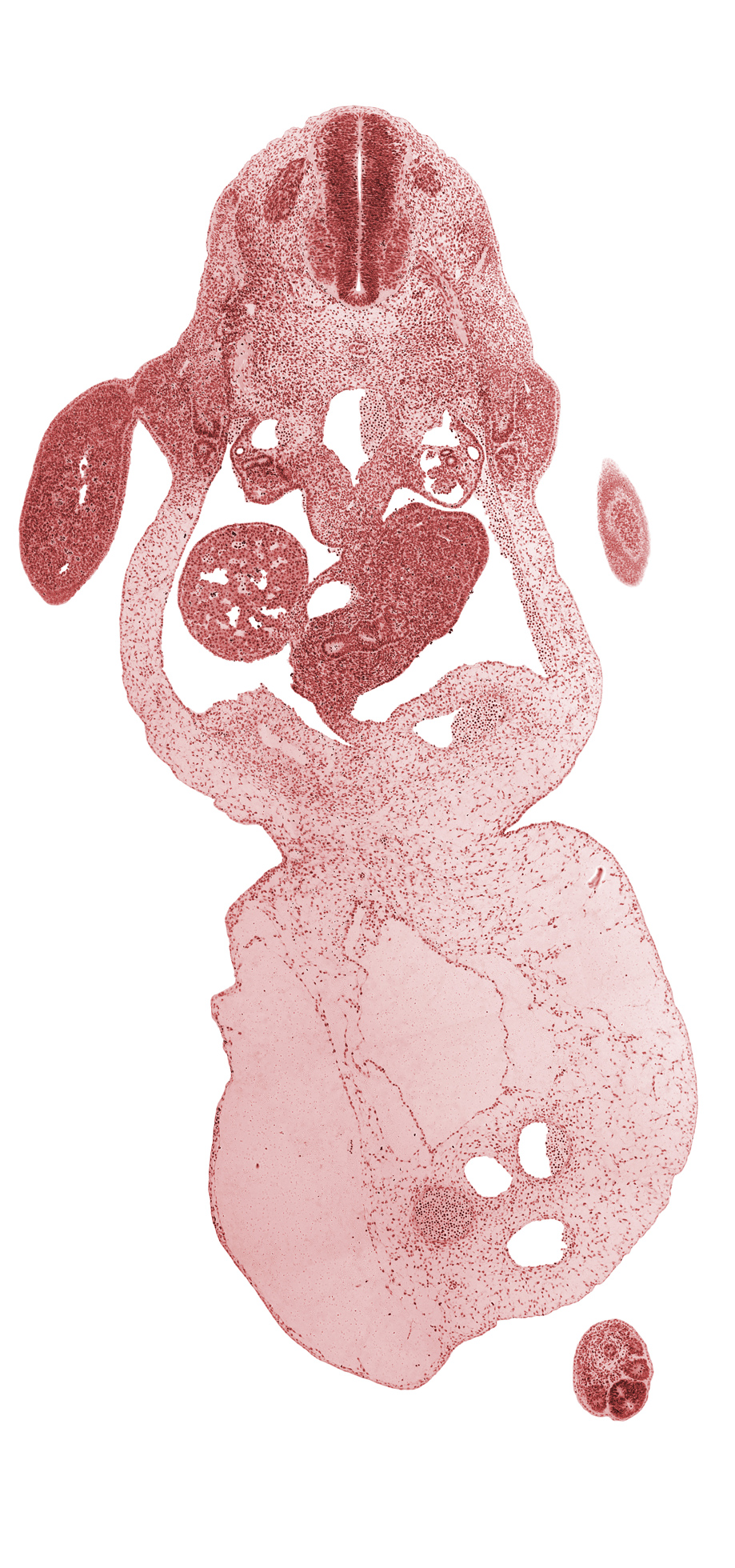 allantois, aorta, caudal end of upper limb, caudal part of C-8 spinal ganglion, caudal part of liver, caudal part of septum transversum, celiac artery, coccygeal somites, common umbilical vein, dorsal pancreas, duodenum, involuting right umbilical vein, junction of duodenum and hepatic duct, left umbilical artery, left umbilical vein, neural tube, notochord, omphalomesenteric (superior mesenteric) vein, post anal gut, right umbilical artery, umbilical coelom, upper limb, ventral body wall