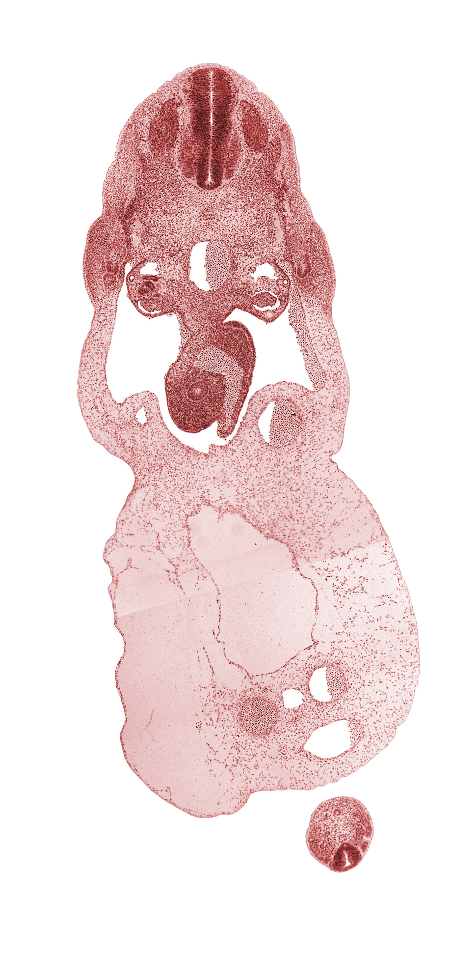 Co-1 spinal ganglion, T-1 spinal ganglion, allantois, amnion on surface of umbilical cord, aorta, common umbilical vein, dermatomyotome, gonadal ridge, involuting right umbilical vein, left umbilical artery, left umbilical vein, mammary crest, mesonephric artery, mesonephric duct, midgut, myotome, neural canal, neural tube, notochord, omphalomesenteric (superior mesenteric) vein, peritoneal cavity, post anal gut, right umbilical artery, sclerotome, umbilical coelom, umbilical cord