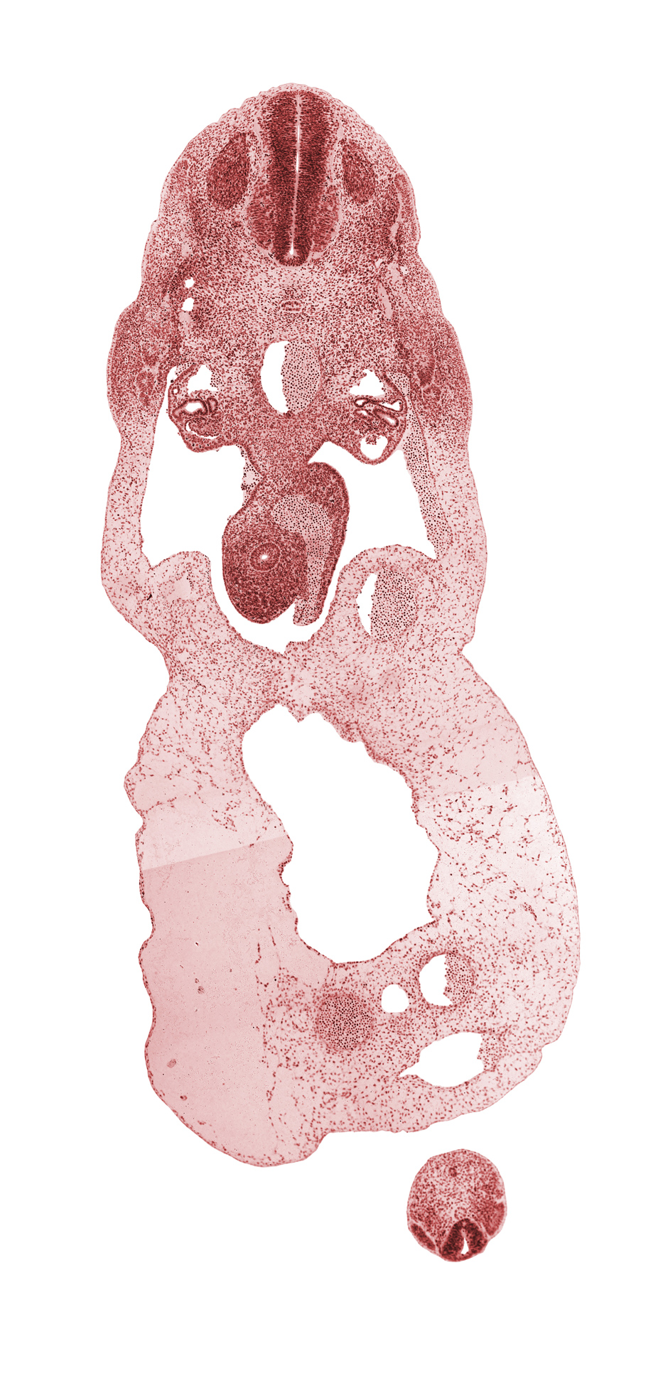 S-5 / Co-1 interganglion region, T-1 spinal ganglion, allantois, aorta, common umbilical vein, dermatome, dermatomyotome, distal limb of midgut loop, involuting right umbilical vein, left umbilical artery, left umbilical vein, mammary crest, myotome, neural canal, neural tube, notochord, omphalomesenteric vein, peritoneal cavity, post anal gut, right umbilical artery, sclerotome, umbilical coelom, umbilical cord