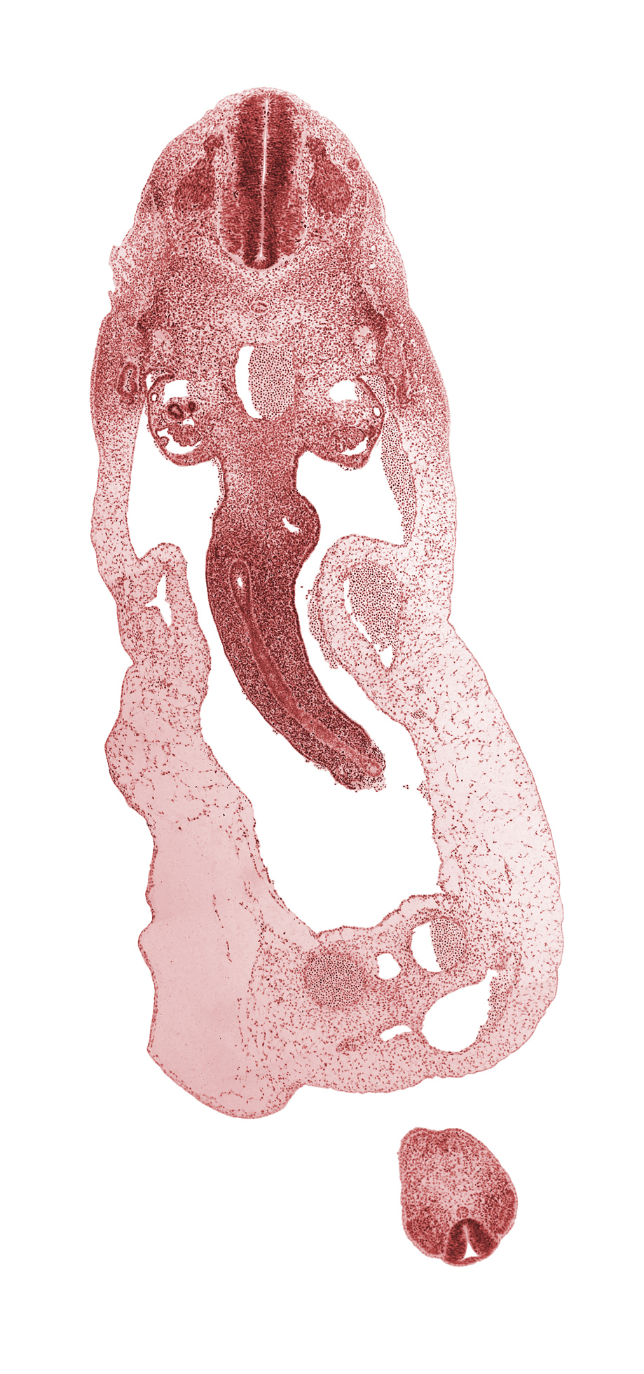 S-4 / S-5 interganglion region, allantois, aorta, caudal edge of T-1 spinal ganglion, cephalic part of T-2 spinal ganglion, cloacal membrane, common umbilical vein, dermatomyotome, dorsal mesentery, glomerulus, involuting right umbilical vein, junction of collecting tubule and mesonephric duct, left umbilical artery, left umbilical vein, mesonephric duct, neural tube, notochord, omphalomesenteric (superior mesenteric) vein, peritoneal cavity, postcardinal vein, proximal limb of midgut loop, right umbilical artery, roof plate, sclerotome, umbilical coelom, umbilical cord