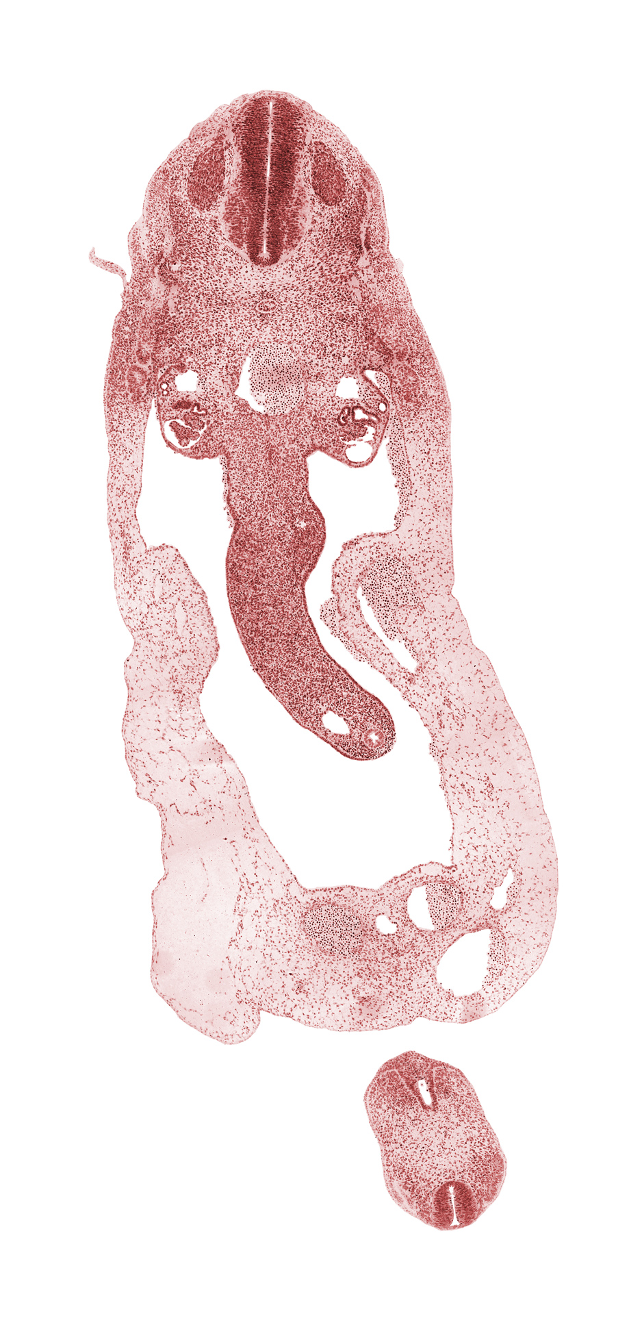 S-4 spinal ganglion, T-2 spinal ganglion, allantois, anal tubercle, cloaca, cloacal membrane, dermatomyotome, dorsal mesentery, glomerulus, intermediate zone, involuting right umbilical vein, left umbilical artery, left umbilical vein, marginal zone, mesonephric duct, mesonephric vesicle(s), midgut loop, neural tube, notochord, right umbilical artery, superior mesenteric artery, umbilical coelom, ventricular zone