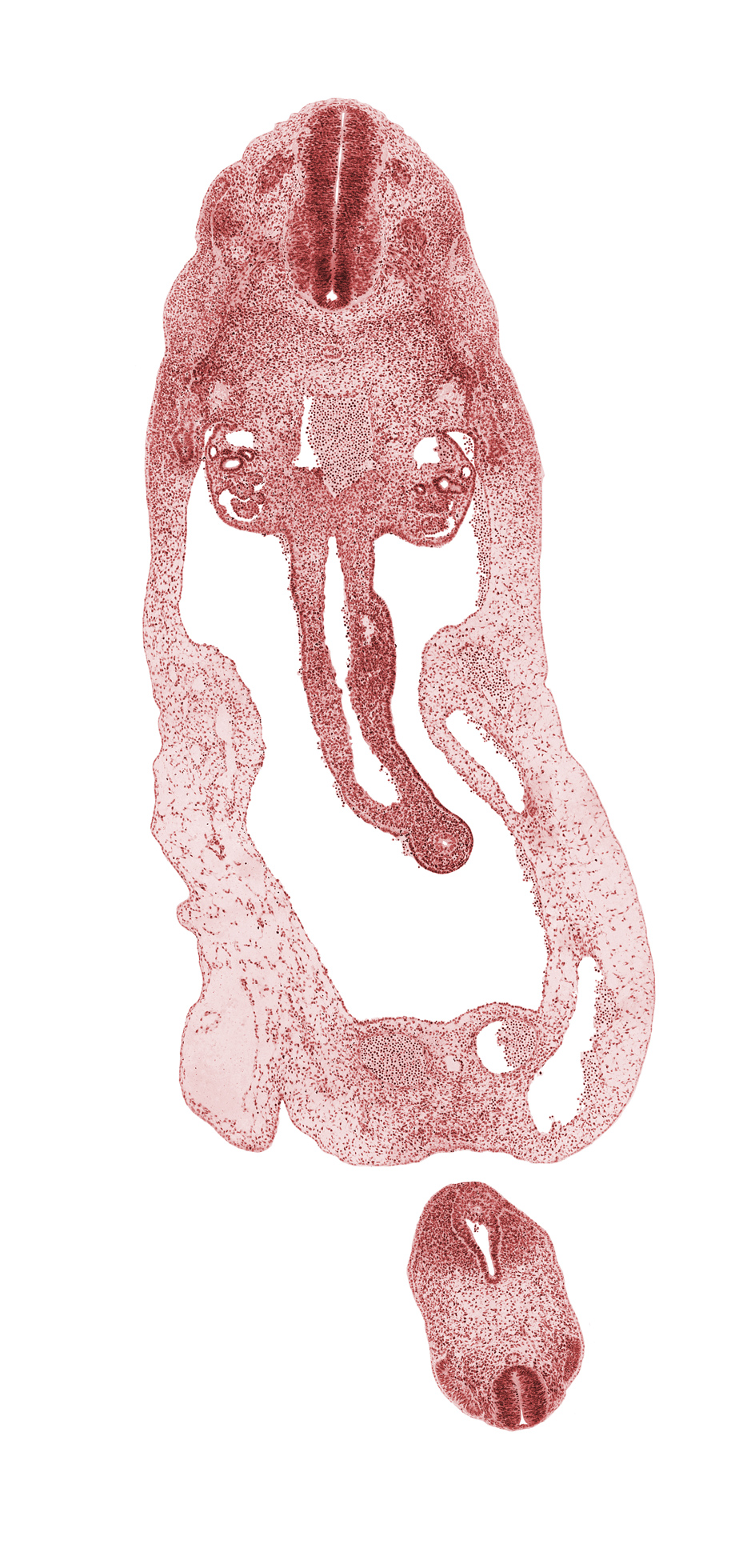 S-3 spinal ganglion, abdominal wall, allantois, aorta, caudal edge of T-2 spinal ganglion, cephalic edge of T-3 spinal ganglion, cloaca, cloacal membrane, dermatomyotome, dorsal mesentery, glomerulus, involuting right umbilical vein, left umbilical artery, left umbilical vein, mesonephric duct, midgut, notochord, omphalomesenteric (superior mesenteric) vein, peritoneal cavity, postcardinal vein, right umbilical artery, sclerotome, superior mesenteric artery, surface ectoderm, umbilical coelom, ventral body wall