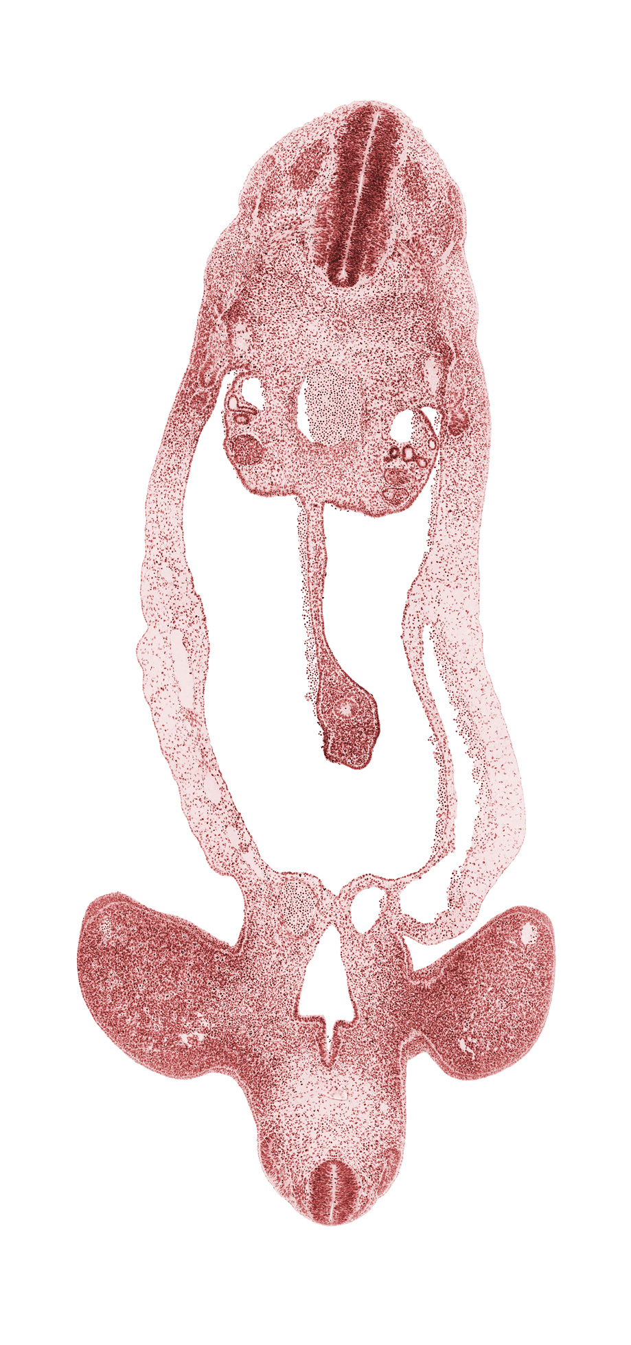 S-1 / S-2 interganglion region, abdominal wall, allantois, aorta, caudal part of T-3 spinal ganglion, cloaca, dorsal mesentery, gonadal ridge, hindgut, involuting right umbilical vein, junction of allantois and cloaca, junction of cloaca and hindgut, junction of cloaca and mesonephric duct, junction of lower limb and pelvic region, left umbilical artery, left umbilical vein, lower limb, marginal vein, mesonephric duct, midgut loop, neural canal, neural tube, notochord, peritoneal cavity, sclerotome