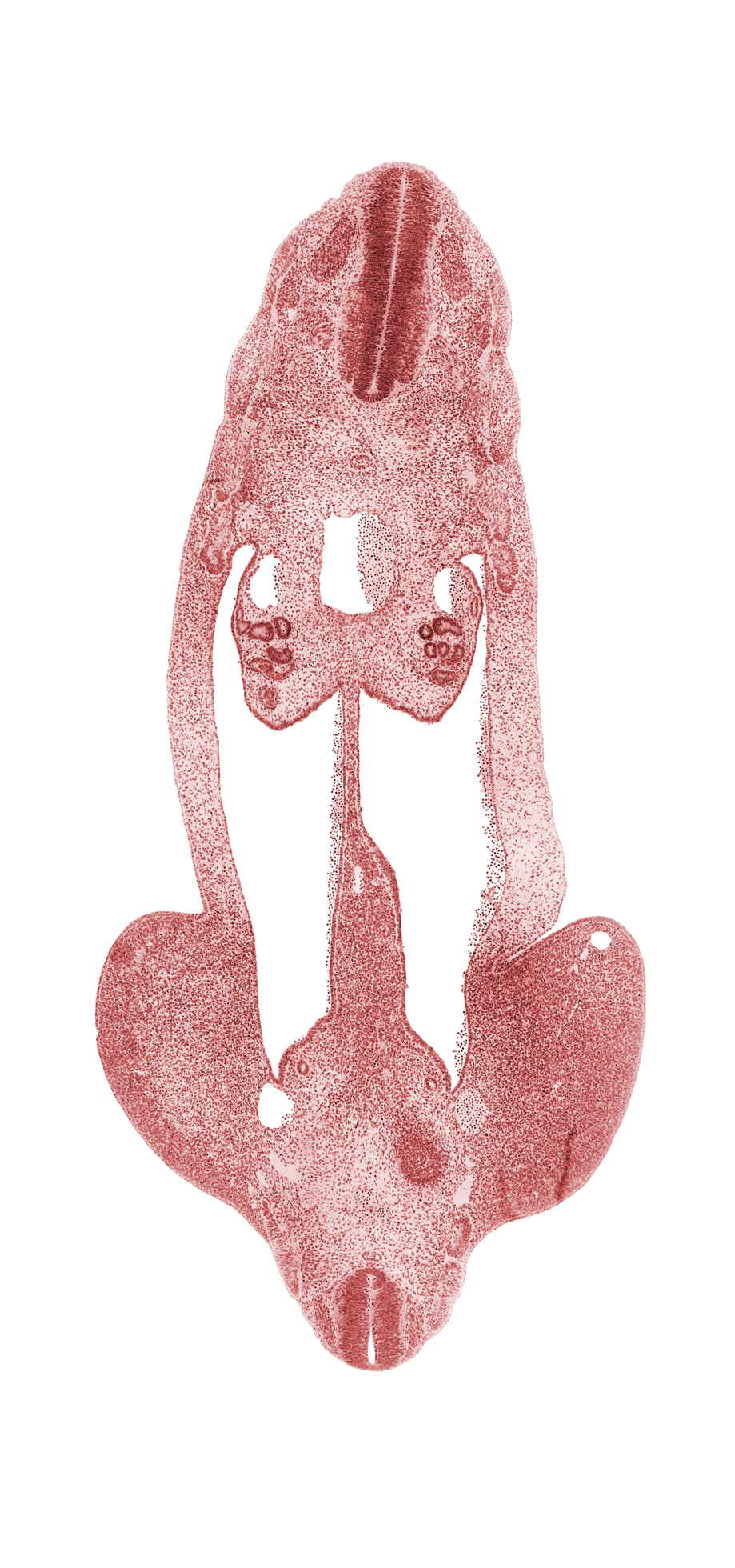 L-5 spinal ganglion, T-4 spinal ganglion, abdominal wall, aorta, cephalic edge of metanephric cap, common iliac artery, dermatome, dermatomyotome, dorsal mesentery, gonadal ridge, inferior mesenteric artery, limb mesenchyme, mesonephric duct, myotome, neural canal, neural tube, notochord, peritoneal cavity, postcardinal vein, sclerotome, splanchnic mesenchyme