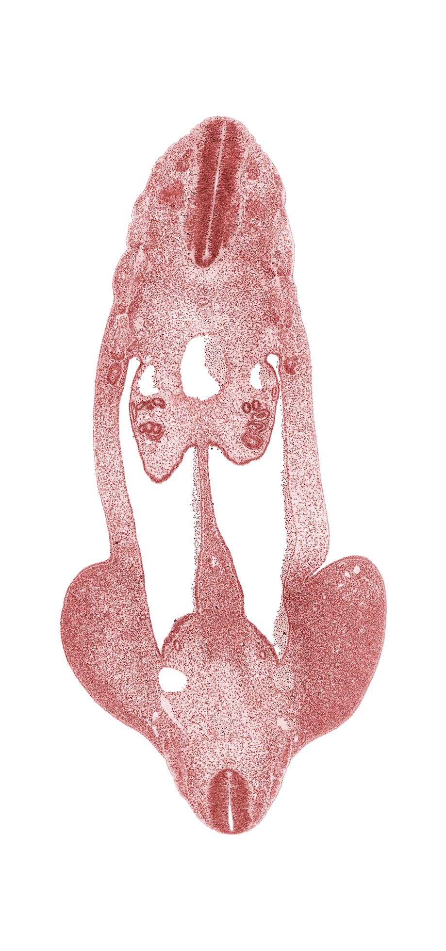 L-5 spinal ganglion, T-4 spinal ganglion, T-5 spinal ganglion, aorta, common iliac artery, dermatomyotome, inferior mesenteric artery, marginal vein, mesonephric duct, neural canal, notochord, peritoneal cavity, postcardinal vein, sclerotome