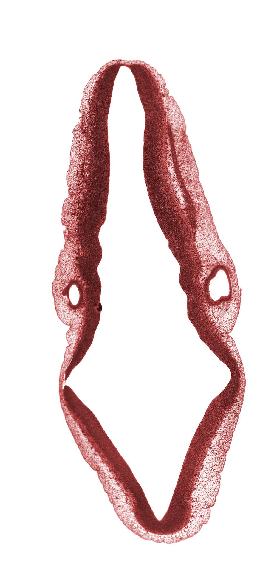 cephalic part of superior ganglion of vagus nerve (CN X), isthmus of rhombencephalon, junction of endolymphatic duct and vestibular part of otic vesicle, junction of isthmus and mesencephalon, mesencephalon (M2), myelencephalon (rhombomere D), rhombencoel (fourth ventricle), rhombomere 1, rhombomere 6, rhombomere 7, roof plate, spinal accessory nerve (CN XI), sulcus limitans, transverse rhombencephalic sulcus