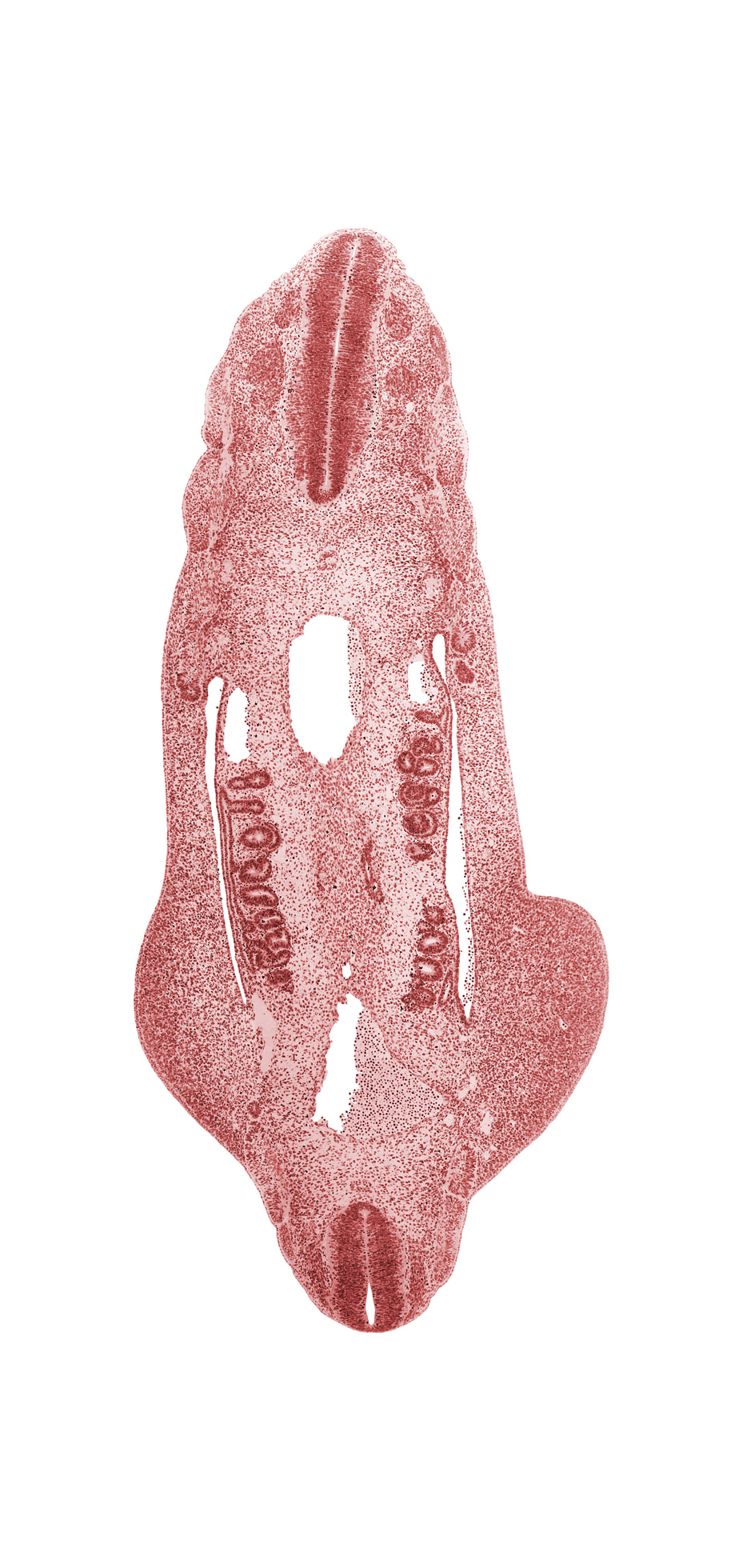 L-4 spinal ganglion, T-5 spinal ganglion, aorta, dense caudal part of sclerotome, inferior mesenteric artery, left common iliac artery, mesonephric duct, mesonephric vesicle(s), neural tube, notochord, postcardinal vein, right common iliac artery