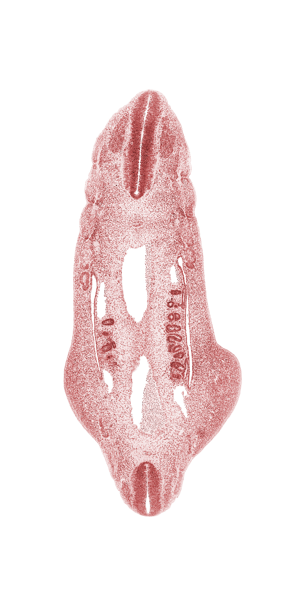 L-4 spinal ganglion, T-5 spinal ganglion, alar plate(s), aorta, basal plate, dense caudal part of sclerotome, dermatome, floor plate, hip region, mesonephric duct, mesonephric vesicle(s), myotome, notochord, peritoneal cavity, postcardinal vein, roof plate, sulcus limitans, surface ectoderm