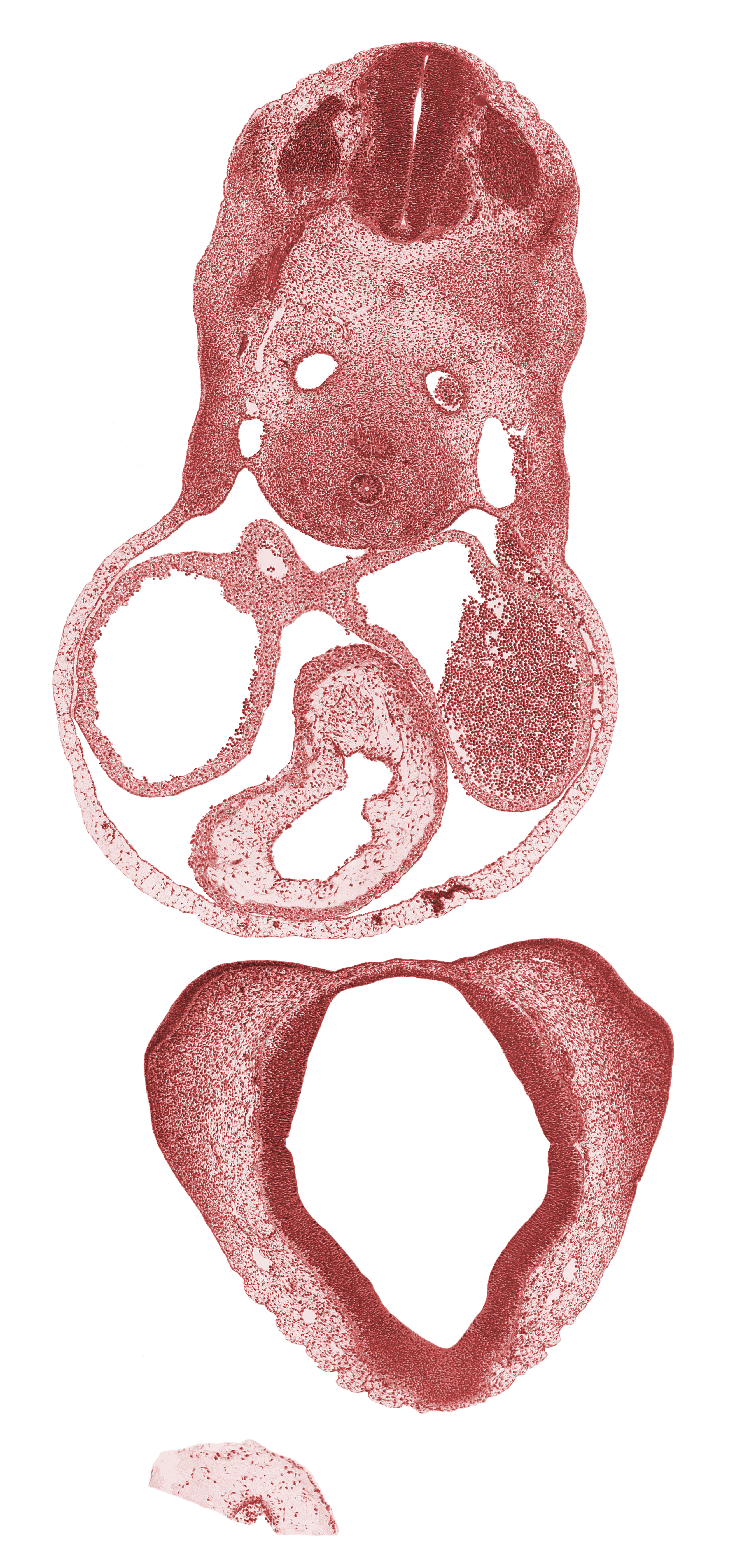 C-4 spinal ganglion, cerebral primordium (vesicle), conotruncal ridge(s), conus cordis (outflow tract), corpus striatum, dorsal aorta, esophagus primordium, left atrium, left precardinal vein, medial nasal prominence(s), nasal capsule, notochord, optic groove, pericardial cavity, right atrium, right precardinal vein, sclerotome, sinus venosus, trachea, truncus arteriosus (outflow tract)