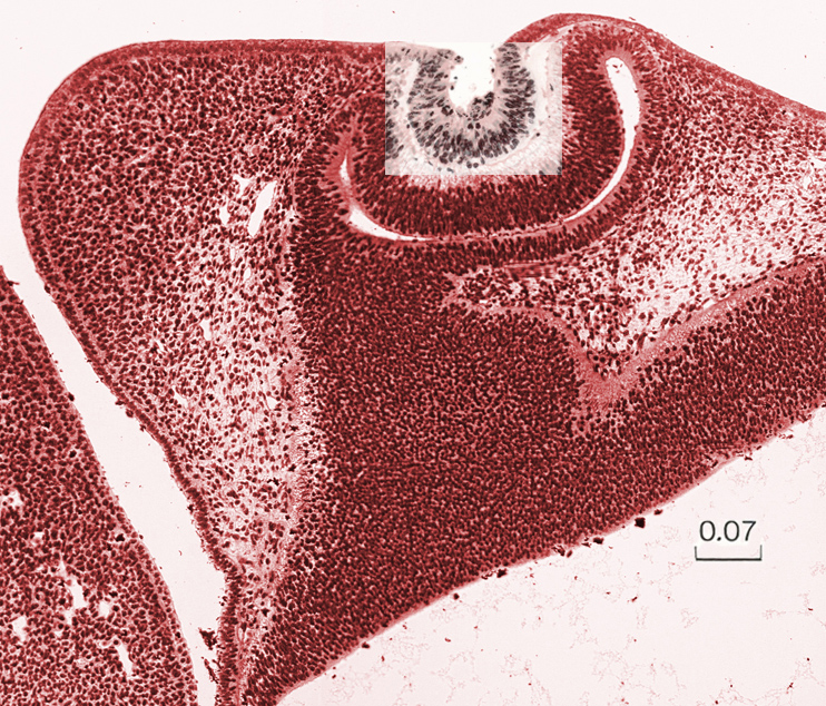 Section through the lens - Overlay