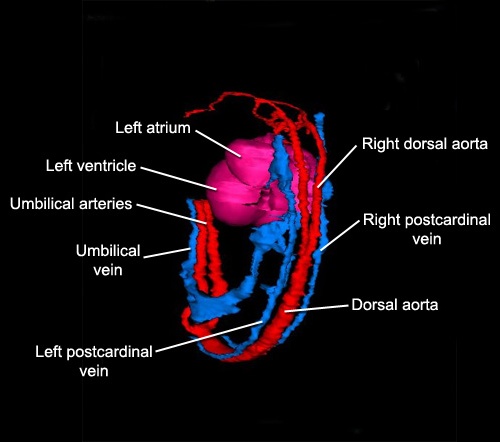 Circulation - Posterior Circulation