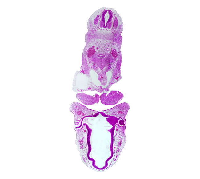 C-4 spinal ganglion, anterior dural venous plexus, aortic sac, caudal edge of ultimopharyngeal pouch, dorsal aorta, dorsal thalamus, lens vesicle, mandibular prominence of pharyngeal arch 1, maxillary prominence of pharyngeal arch 1, median mandibular groove, notochord, optic chiasma (chiasmatic plate), optic stalk (CN II), oronasal cavity, pericardial cavity, precardinal vein (internal jugular vein), primordial olfactory artery, pulmonary arch, synencephalon, third ventricle, ventral thalamus