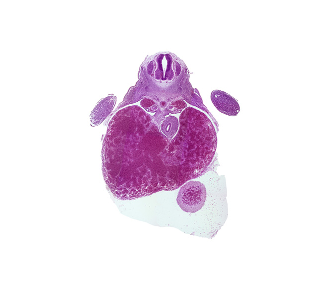 T-1 spinal ganglion, aorta, cephalic part of stomach, ductus venosus, left ventricle, liver, pericardial cavity, peritoneal cavity, postcardinal vein, septum transversum, upper limb