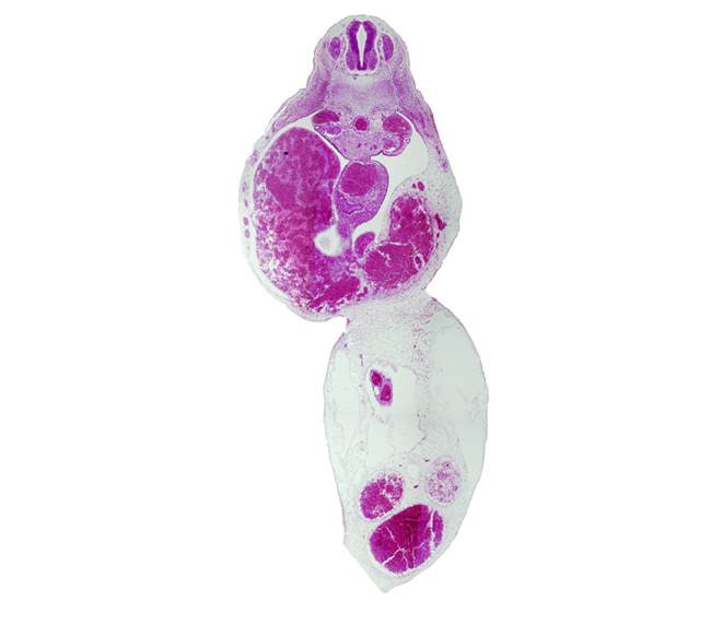 T-5 spinal ganglion, aorta, duodenum, junction of left umbilical vein and liver, junction of liver and right umbilical vein, left umbilical artery, liver, mesonephric duct, peritoneal cavity, umbilical coelom, umbilical vein, ventral pancreas, vitelline (omphalomesenteric) artery, vitelline (omphalomesenteric) vein