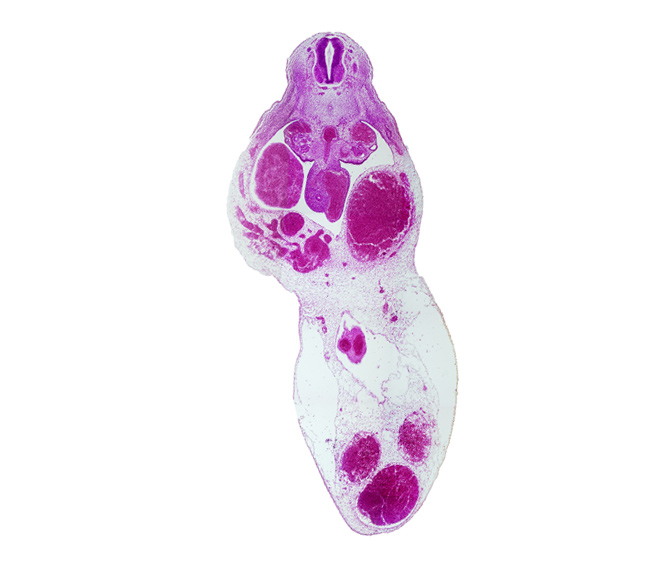 alar plate(s), allantois, aorta, basal plate, cephalic edge of T-6 spinal ganglion, floor plate, gonadal ridge, left umbilical artery, left umbilical vein (congested), mesonephric duct, mesonephric tubule(s), midgut, right umbilical artery, roof plate, sulcus limitans, superior mesenteric artery, umbilical coelom, umbilical vein, vitelline (omphalomesenteric) artery, vitelline (omphalomesenteric) vein