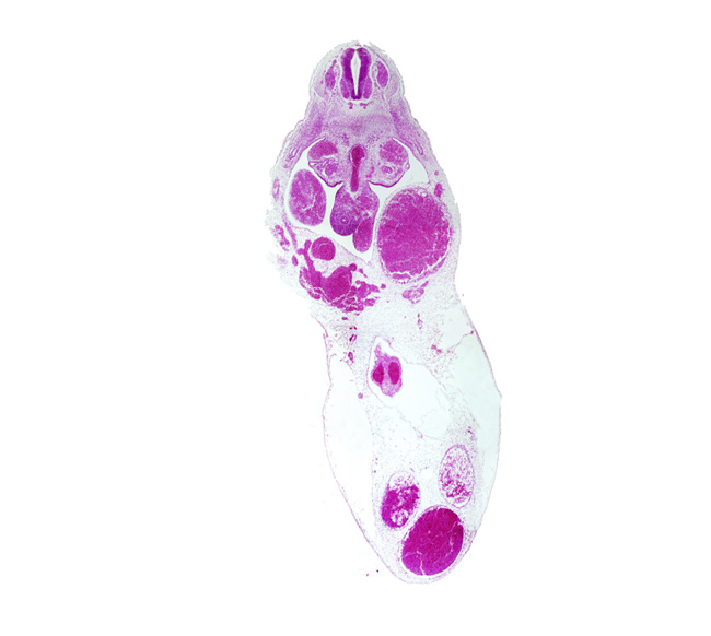 T-6 spinal ganglion, gonadal ridge, left umbilical artery, left umbilical vein (congested), liver, midgut, origin of superior mesenteric artery from aorta, right umbilical artery, right umbilical vein, umbilical cord, umbilical vein, vitelline (omphalomesenteric) artery, vitelline (omphalomesenteric) vein