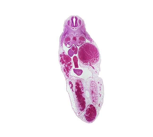 T-7 spinal ganglion, allantois, gonadal ridge, left umbilical vein (congested), mesonephric duct, midgut, right umbilical vein, superior mesenteric artery, vitelline (omphalomesenteric) vein