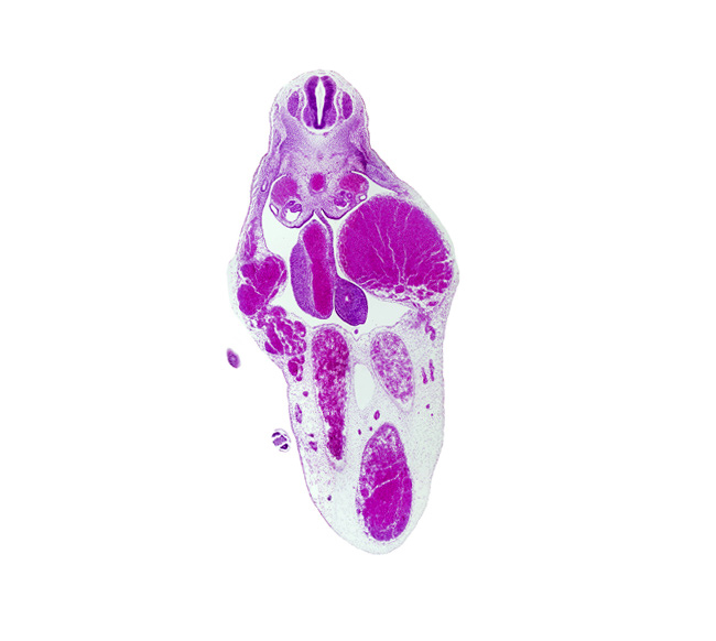 T-8 spinal ganglion, allantois, aorta, caudal edge of foot plate, caudal eminence, left umbilical artery, left umbilical vein, mesonephric duct, midgut, right umbilical artery, superior mesenteric artery, umbilical vein