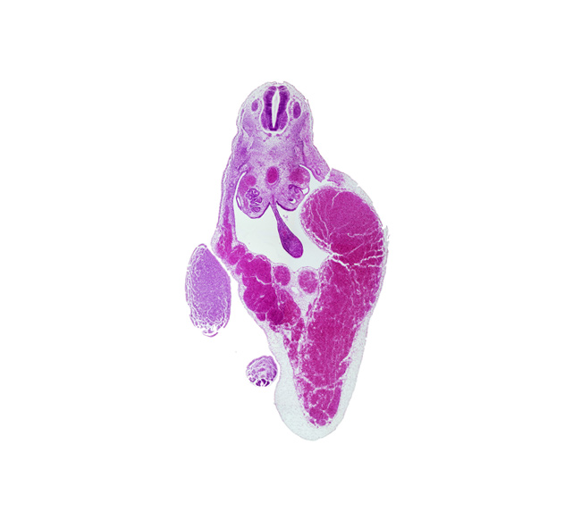 T-9 spinal ganglion, aorta, caudal eminence, common umbilical vein, dermatomyotome, dorsal mesentery, gonadal ridge, junction of umbilical veins, left umbilical vein (congested), mesonephric duct, midgut, peritoneal cavity, rib primordium, right umbilical vein, umbilical cord