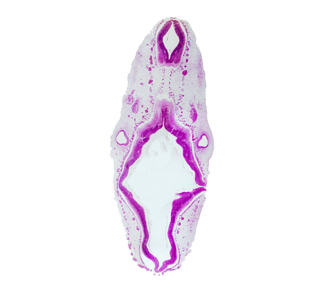 anterior dural venous plexus, caudal part of rhombencephalon, intermediate zone, junction of endolymphatic duct and vestibular part of otic vesicle, marginal zone, mesencephalon (M2), mesencoel (cerebral aqueduct), metencephalic arteries, middle dural venous plexus, origin of glossopharyngeal nerve (CN IX), posterior dural venous plexus, rhombencoel (fourth ventricle), rhombomere 4, rhombomere 5, rhombomere 6, sulcus limitans, superior ganglion of vagus nerve (CN X), vascular plexus, ventricular zone