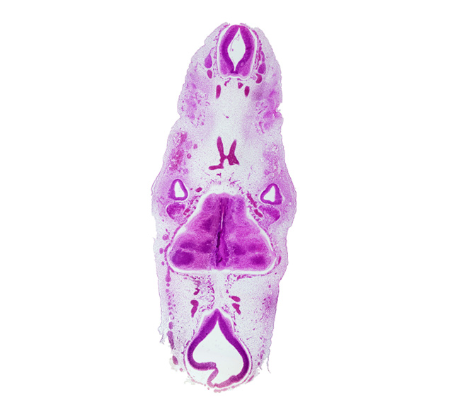 C-1 spinal ganglion, abducens nerve area (CN VI), anterior spinal artery, caudal edge of rhombencoel (fourth ventricle), cervical part of spinal cord, glossopharyngeal nerve (CN IX), hypoglossal nerve (CN XII), intermediate zone, marginal zone, mesencoel (cerebral aqueduct), metencephalic arteries, stem of anterior inferior cerebellar artery, stem of posterior dural venous plexus, vagus nerve (CN X), ventricular zone, vertebral artery, vestibular part of otic vesicle, vestibulocochlear nerve (CN VIII)