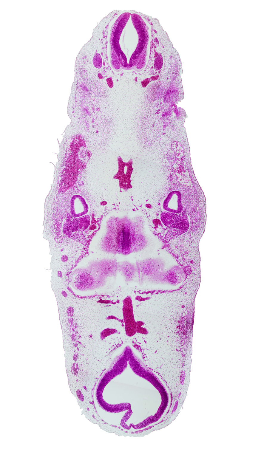 C-1 spinal ganglion, anterior dural venous plexus, basilar artery, caudal edge(s) of rhombencephalon, facial nerve (CN VII), glossopharyngeal nerve (CN IX), junction of basilar artery and vertebral arteries, mesencoel (cerebral aqueduct), origin of metencephalic artery (superior cerebellar), root of trigeminal nerve (CN V), semicircular groove, stem of middle dural venous plexus, stem of posterior dural venous plexus, tectum, tegmentum, vertebral artery, vestibulocochlear ganglion (CN VIII)