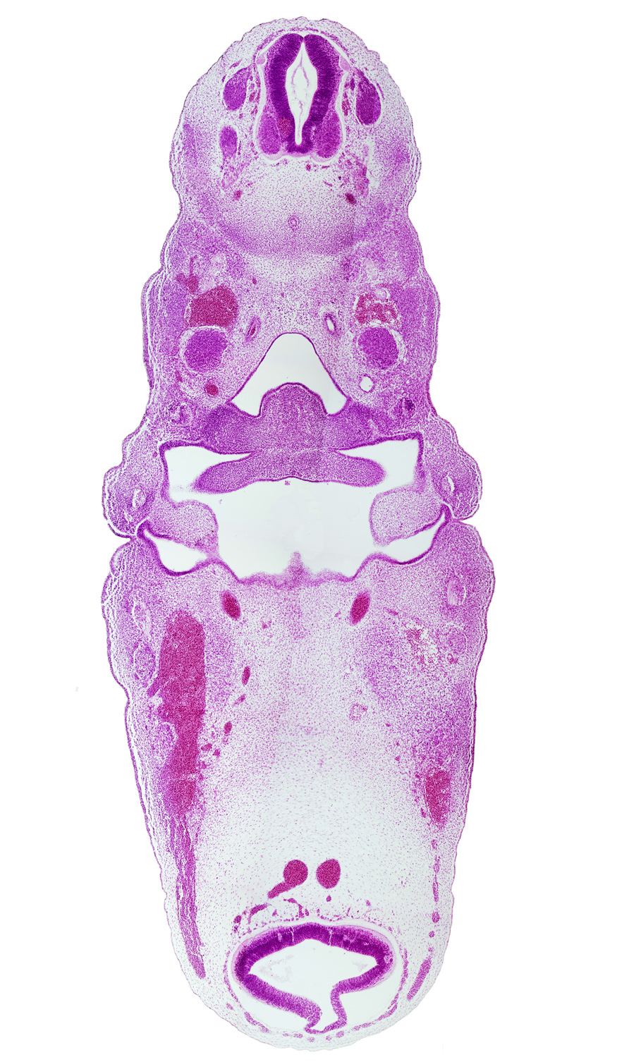 C-3 spinal ganglion, aortic arch 3, central canal, cephalic end of notochord, dorsal aorta, facial nerve (CN VII), foramen cecum of tongue, glossopharyngeal nerve (CN IX), hypopharyngeal eminence of tongue, inferior ganglion of vagus nerve (CN X), intermediate zone, internal carotid artery, junction of anterior dural venous plexus and primordial maxillary vein, laryngeal pharynx, mandibular nerve (CN V₃), marginal zone, maxillary nerve (CN V₂), mesencephalon (M2), nasopharynx, notochord, origin of mesencephalon artery, pharyngeal groove 1, pharyngeal pouch 1, pharyngeal pouch 2, posterior cerebral artery, sclerotome, sulcus limitans, ventral root, ventricular zone, vertebral artery