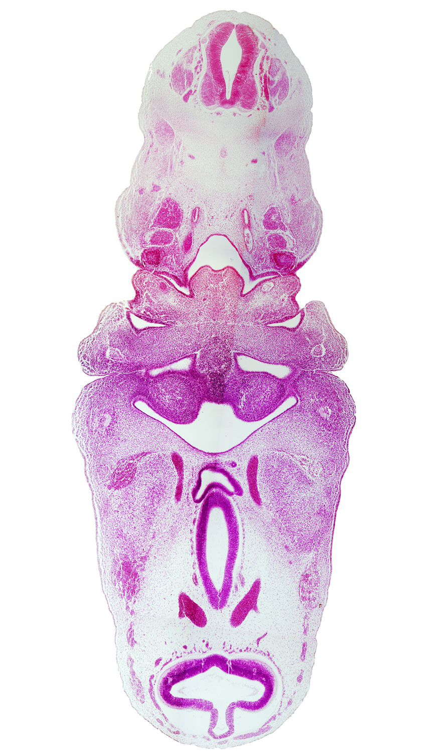 C-3 spinal ganglion, adenohypophysial pouch, aortic arch 3, aortic arch 4, auricular hillock, dorsal aorta, facial nerve (CN VII), hypothalamus, internal carotid artery, junction of aortic arch 4 and dorsal aorta, lateral lingual swelling of tongue, mandibular nerve (CN V₃), mesencephalon (M1), mesencoel (cerebral aqueduct), nasopharynx, notochord, pharyngeal arch 3, pharyngeal groove 1, pharyngeal pouch 1, pharyngeal pouch 2, pharyngeal pouch 3, posterior cerebral artery, postoptic recess, region of mesencephalic (cephalic) flexure, third ventricle