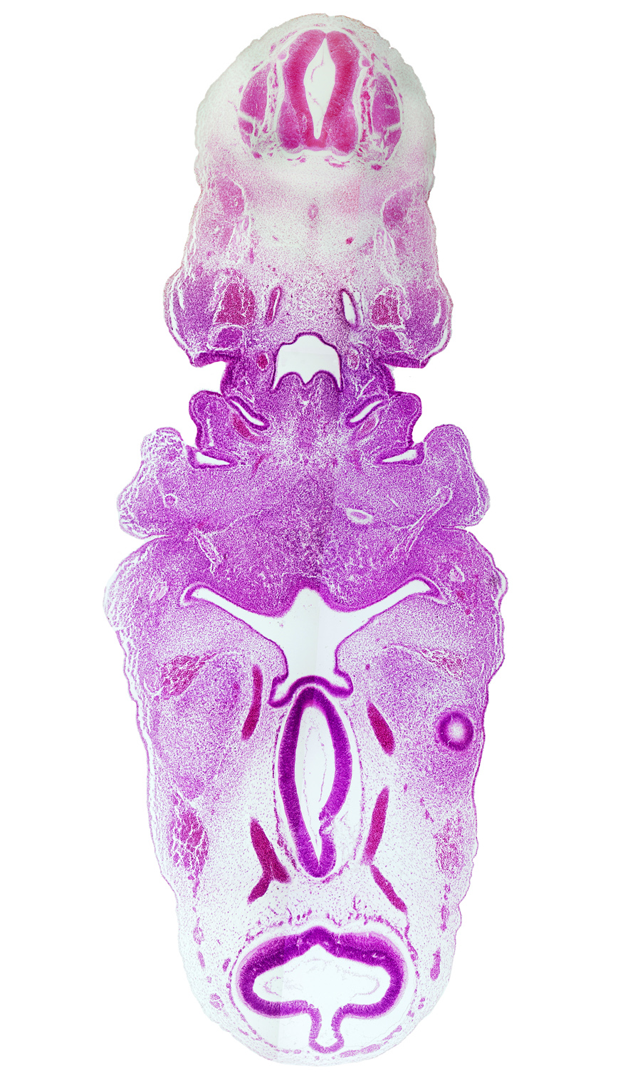 C-3 spinal ganglion, adenohypophysial pouch, aortic arch 3, aortic arch 4 (aortic arch), cephalic edge of optic cup, cervical sinus, chorda tympani nerve, collapsed tectum of mesencephalon (M1), dorsal aorta, facial nerve (CN VII), hypothalamic sulcus, internal carotid artery, lateral lingual swelling of tongue, mandibular nerve (CN V₃), mandibular prominence of pharyngeal arch 1, maxillary nerve (CN V₂), pharyngeal arch 3, pharyngeal arch 4, pharyngeal pouch 2, pharyngeal pouch 3, posterior communicating artery, primordial maxillary vein, region of mesencephalic (cephalic) flexure, stem of anterior dural venous plexus, thyroglossal duct