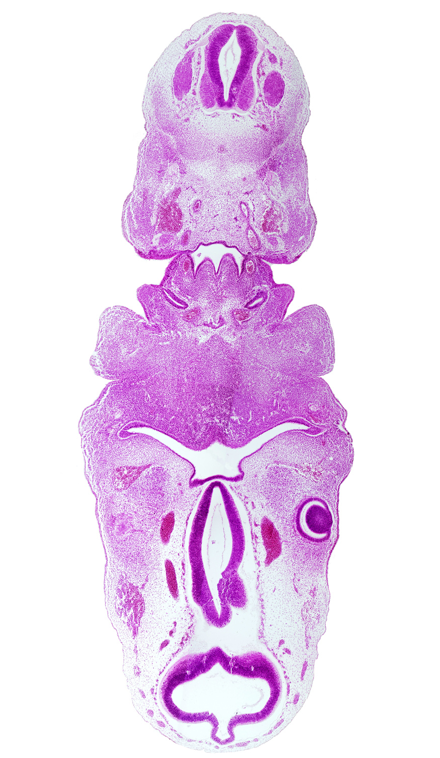 C-3 spinal ganglion, adenohypophysial pouch, aortic arch 3, aortic arch 4, bilobed thyroid gland, cervical sinus, diencephalon, dorsal aorta, hypothalamic sulcus, hypothalamus, junction of dorsal aorta and pulmonary arch, lateral lingual swelling of tongue, mandibular nerve (CN V₃), mandibular prominence of pharyngeal arch 1, maxillary nerve (CN V₂), mesencephalon (M1), nasopharynx, pharyngeal arch 2, pharyngeal arch 3, pharyngeal groove 1, pharyngeal pouch 3, posterior communicating artery, region of mesencephalic (cephalic) flexure, subthalamus, sulcus limitans, tectum, tegmentum, third ventricle