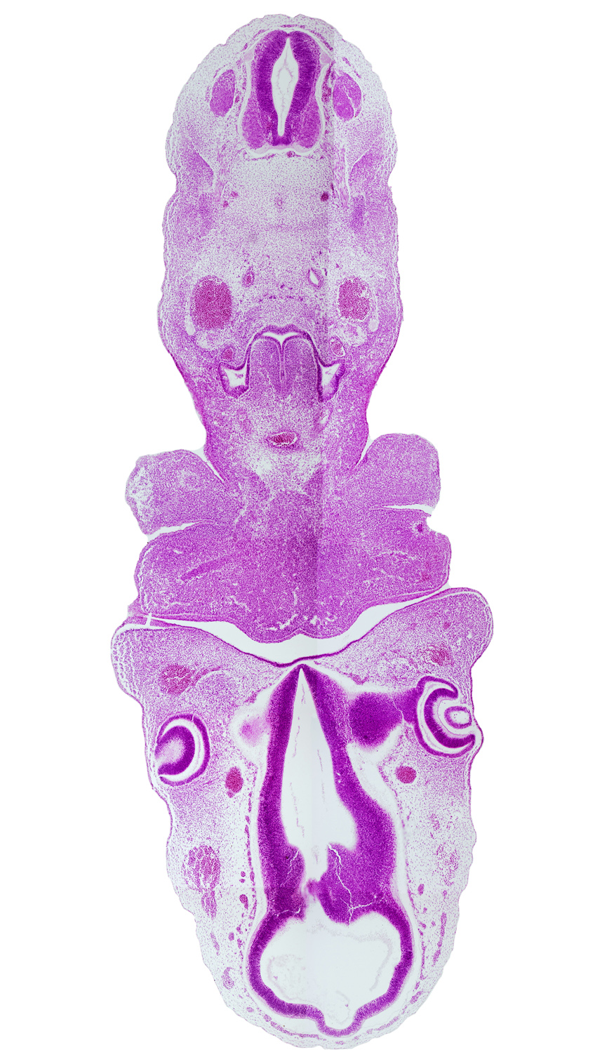 C-4 spinal ganglion, aortic arch 4, aortic sac, dorsal aorta, hypothalamic sulcus, intraretinal space (optic vesicle cavity), junction of mesencoel and third ventricle, laryngeal pharynx, lateral lingual swelling of tongue, lens vesicle, mandibular nerve (CN V₃), maxillary prominence of pharyngeal arch 1, mesencoel (cerebral aqueduct), optic cup cavity, optic stalk (CN II), oral fissure, oronasal cavity, pharyngeal arch 2, pharyngeal pouch 4, precardinal vein (internal jugular vein), primordial maxillary vein, third ventricle, ultimopharyngeal pouch, ventral thalamus, vertebral artery