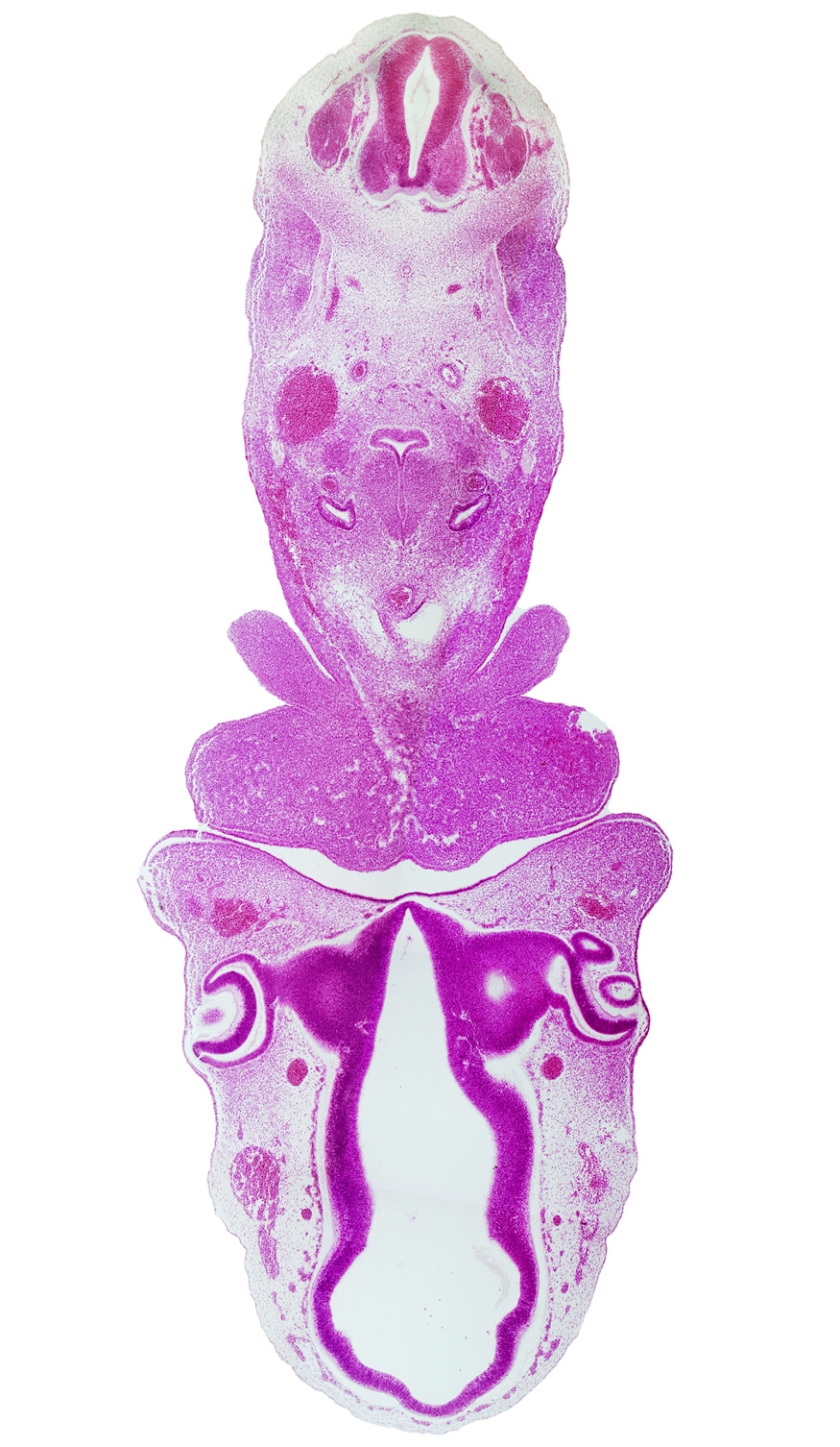 C-4 spinal ganglion, anterior cerebral artery, anterior corneal epithelium, anterior dural venous plexus, aortic sac, central canal, cephalic edge of pericardial cavity, dorsal aorta, dorsal thalamus, lens vesicle, mandibular prominence of pharyngeal arch 1, maxillary prominence of pharyngeal arch 1, median mandibular groove, optic chiasma (chiasmatic plate), optic cup, optic stalk (CN II), pharyngeal arch 2, precardinal vein (internal jugular vein), pulmonary arch, synencephalon, third ventricle, ultimopharyngeal pouch, ventral thalamus, vertebral artery