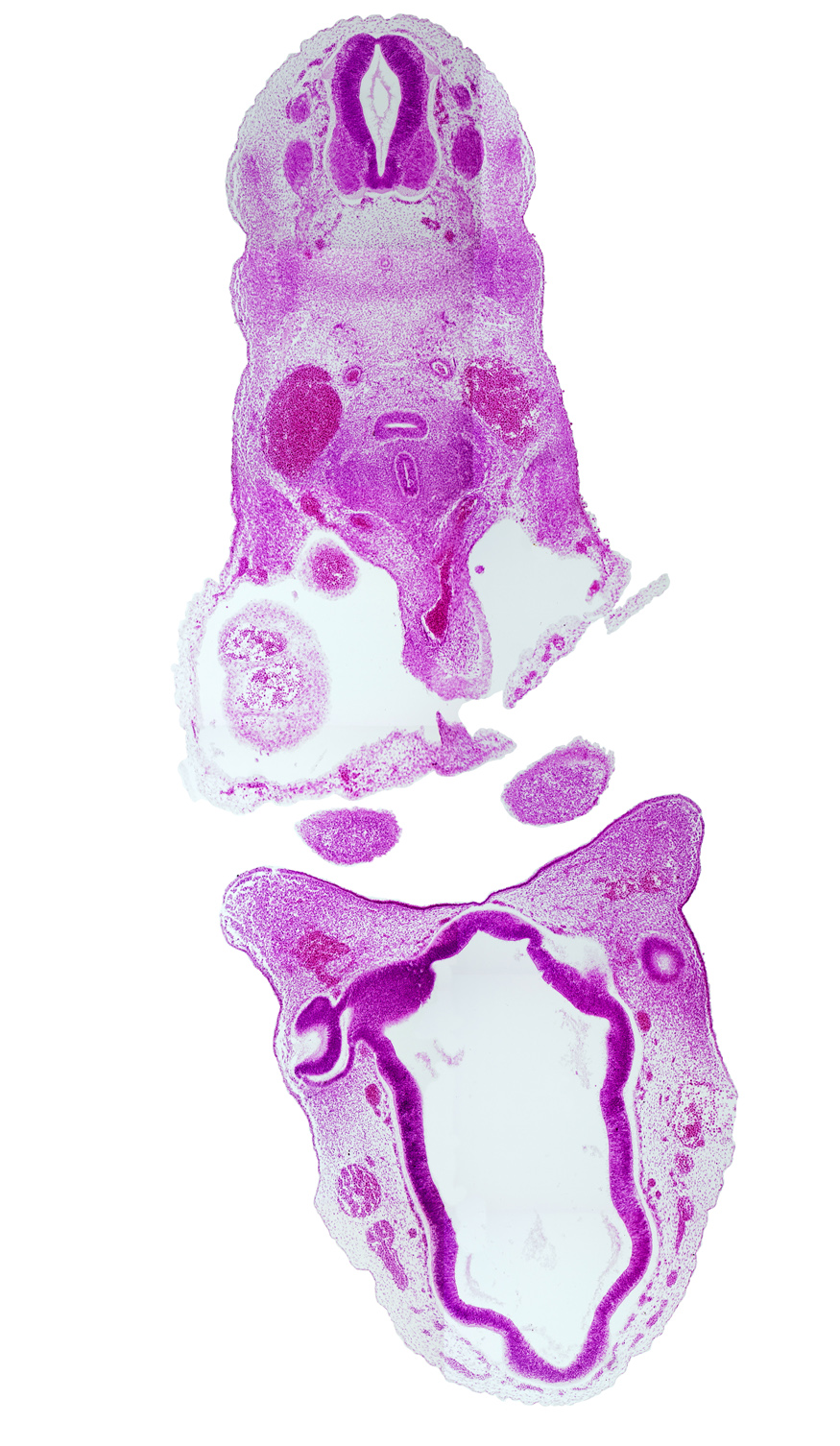 C-4 / C-5 interganglion region, C-4 spinal ganglion, C-5 dorsal root, anterior dural venous plexus, aortic sac, caudal edge of mandibular prominence of pharyngeal arch 1, central canal, cephalic edge of optic cup, cephalic edge of right atrium, dorsal aorta, dorsal thalamus, esophagus, intermediate zone, marginal zone, maxillary prominence of pharyngeal arch 1, notochord, optic chiasma (chiasmatic plate), pericardial cavity, precardinal vein (internal jugular vein), primordial maxillary vein, pulmonary arch, sclerotome, synencephalon, trachea, ventral thalamus, ventricular zone