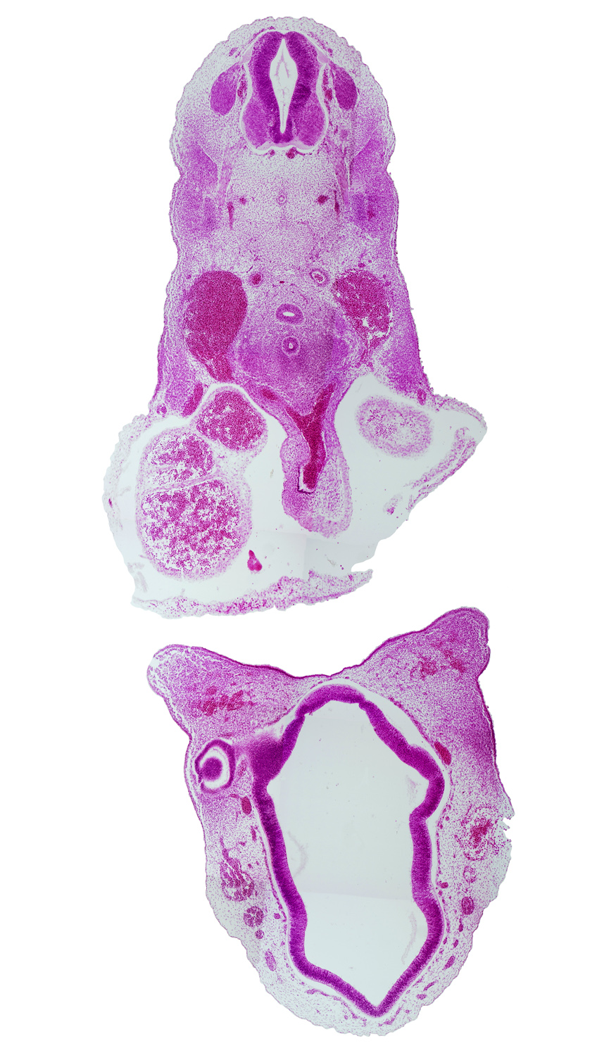 C-5 spinal ganglion, alar plate(s), anterior dural venous plexus, aortic sac, basal plate, cephalic edge of left atrium, diencephalon, dorsal aorta, dorsal thalamus, esophagus, floor plate, lateral ventricle, optic chiasma (chiasmatic plate), pericardial cavity, primordial olfactory artery, pulmonary arch, right atrium, roof plate, sulcus limitans, synencephalon, third ventricle, trachea, truncus arteriosus (outflow tract), ventral thalamus, vertebral artery