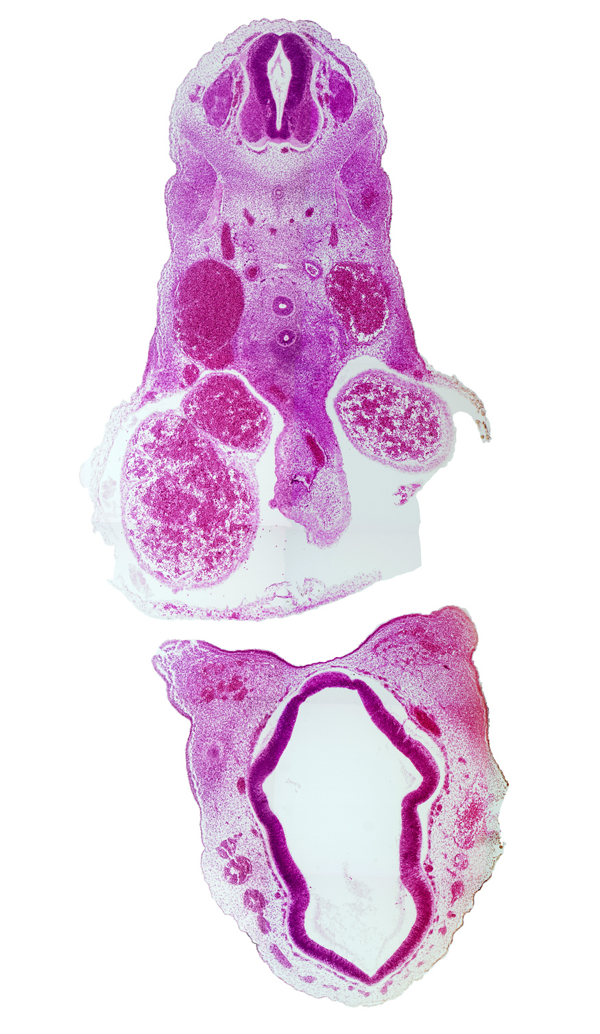 C-5 spinal ganglion, anterior dural venous plexus, central canal, dorsal aorta, dorsal thalamus, esophagus, intermediate zone, left atrium, marginal zone, notochord, optic chiasma (chiasmatic plate), pericardial sac attachment, precardinal vein (internal jugular vein), primordial pineal bud, pulmonary artery, right atrium, trachea, ventral thalamus, ventricular zone