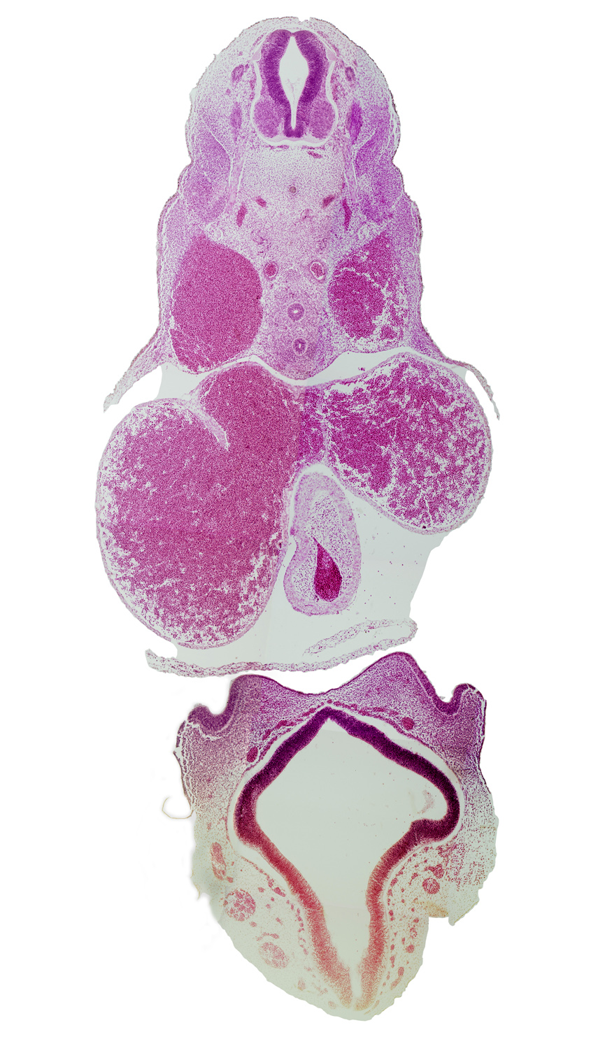 C-5 / C-6 interganglion region, C-5 spinal ganglion, C-5 spinal nerve, cerebral vesicle (telencephalon), common venous valve, disrupted pericardial sac, dorsal aorta, dorsal thalamus, esophagus, lateral nasal prominence, left atrium, medial nasal prominence(s), notochord, pericardial cavity, precardinal vein (internal jugular vein), right atrium, torus hemisphericus, trachea, truncus arteriosus (outflow tract), ventral thalamus