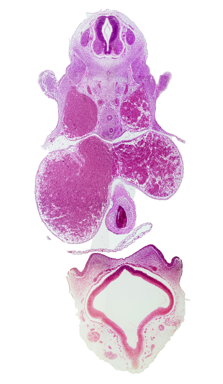C-6 spinal ganglion, C-6 spinal nerve, caudal end of upper limb, cerebral vesicle (telencephalon), dorsal aorta, lateral nasal prominence, left atrium, left venous valve, nasal pit, pericardial sac attachment, pericardial sac remnant, precardinal vein (internal jugular vein), primary interatrial septum (septum primum), right atrium, right venous valve, secondary interatrial foramen (foramen secundum), torus hemisphericus, truncus arteriosus (outflow tract)