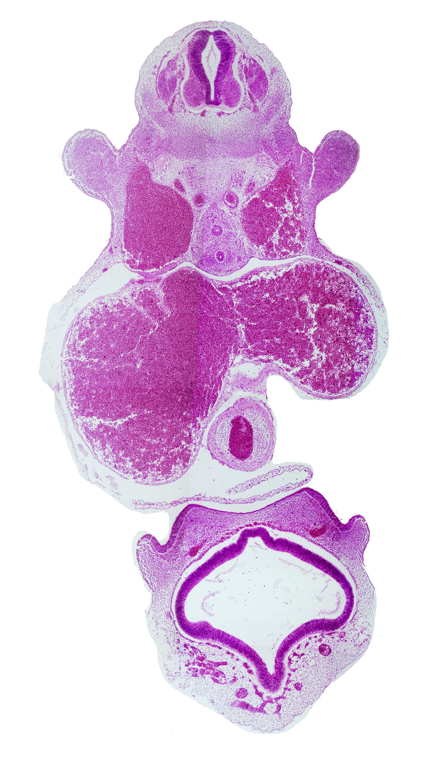 C-6 spinal ganglion, artifact separation(s), central canal, cerebral vesicle (telencephalon), dorsal aorta, esophagus, lateral nasal prominence, lateral ventricle, left atrium, left venous valve, marginal venous sinus, medial nasal prominence(s), nasal pit, primary interatrial septum (septum primum), primordial olfactory artery, right atrium, right venous valve, secondary interatrial foramen (foramen secundum), third ventricle, torus hemisphericus, trachea