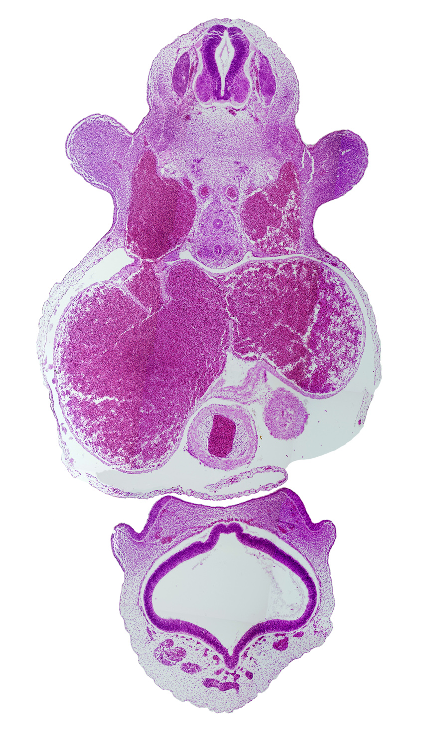 C-6 spinal ganglion, cephalic edge of left ventricle, cerebral vesicle (telencephalon), dorsal aorta, left atrium, marginal venous sinus, nasal disc (olfactory placode), olfactory nerve (CN I), pericardial cavity, precardinal vein (internal jugular vein), primary interatrial septum (septum primum), right atrium, sinus venosus, torus hemisphericus, truncus arteriosus (outflow tract), upper limb