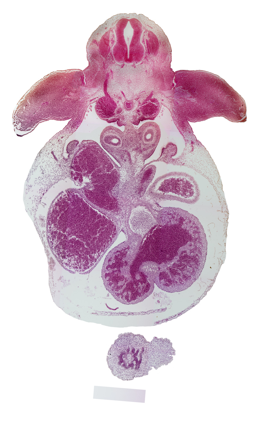 C-8 spinal ganglion, apical epidermal ridge, arm region, brachial plexus, caudal part of left atrium, cephalic edge of liver, ductus venosus, ectoderm, forearm region, interventricular sulcus, left common cardinal vein, left ventricle, mesocardium, pericardioperitoneal canal (pleural cavity), postcardinal vein, right atrium, right ventricle, shoulder region, sinus venosus, vascular plexus