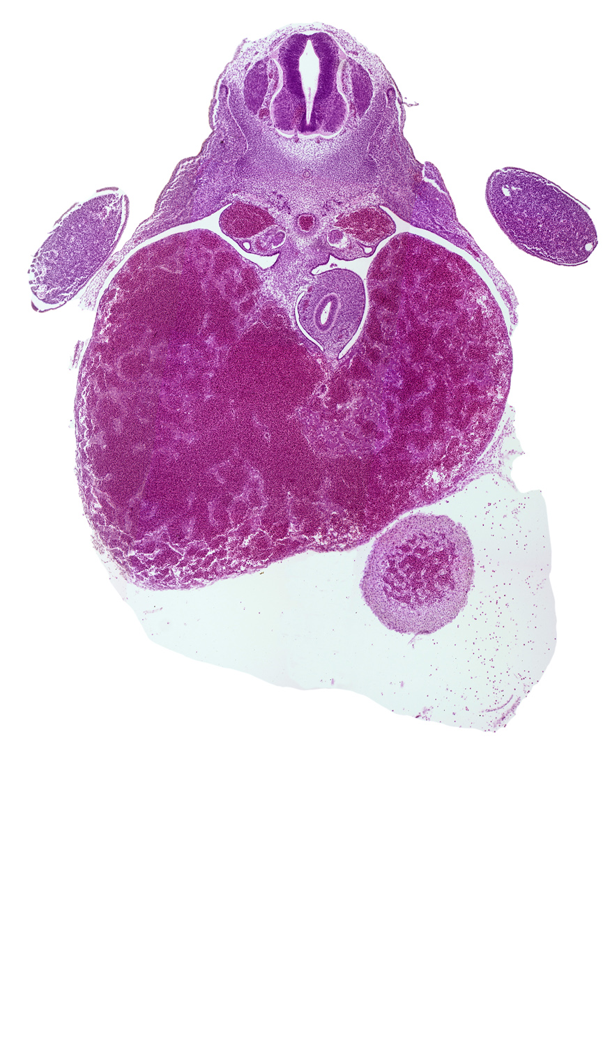 T-1 spinal ganglion, aorta, cephalic part of stomach, ductus venosus, left ventricle, liver, pericardial cavity, peritoneal cavity, postcardinal vein, septum transversum, upper limb