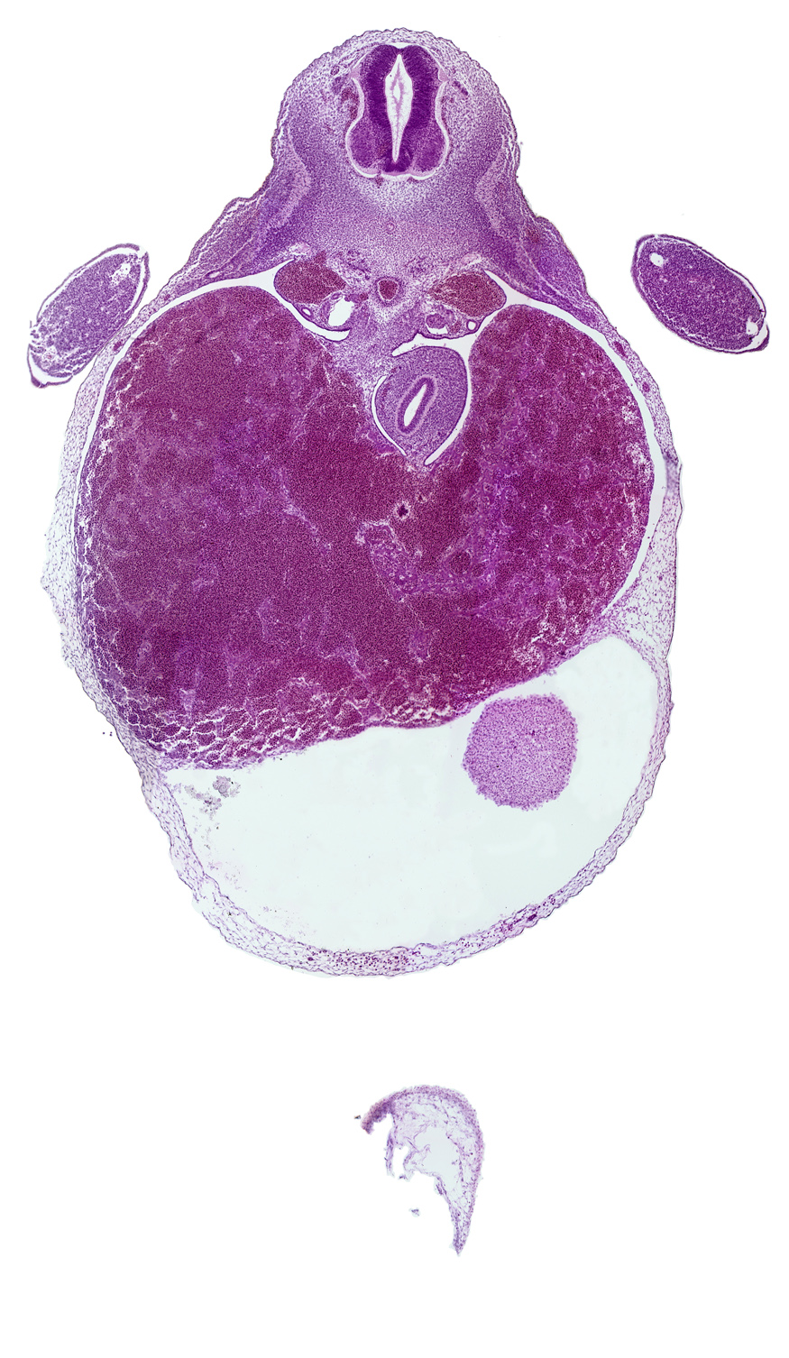 T-1 / T-2 interganglion region, aorta, caudal edge of left ventricle, ductus venosus, liver, mesonephric duct, myotome, neural arch blastema, pericardial cavity, peritoneal cavity, rib blastema, stomach endoderm, upper limb