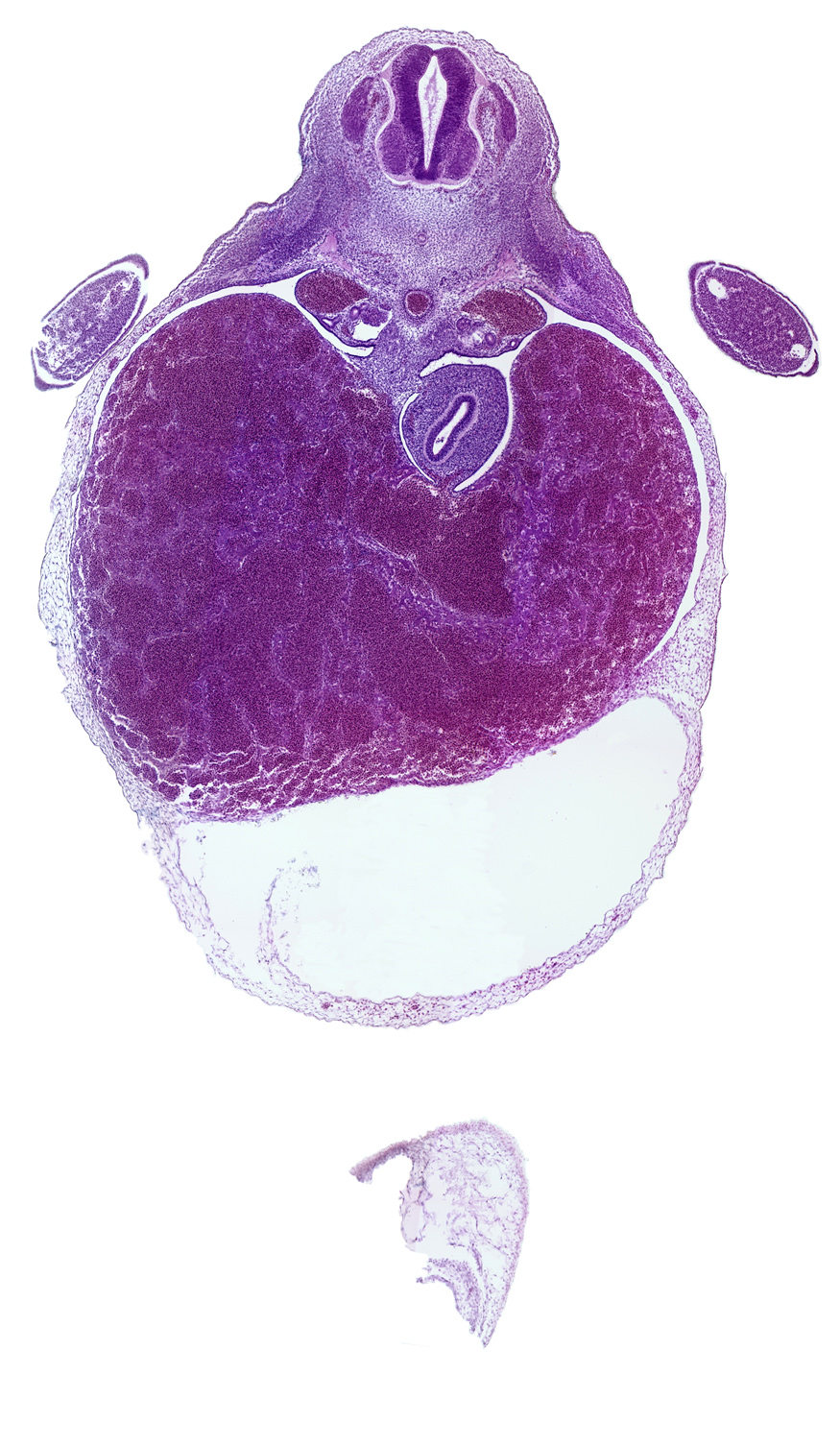 apical epidermal ridge, central canal, cephalic edge of T-2 spinal ganglion, ductus venosus, hand plate, liver, marginal vein, neural arch blastema, pericardial cavity, pericardial sac, right hepatic vein, septum transversum, stomach, upper limb