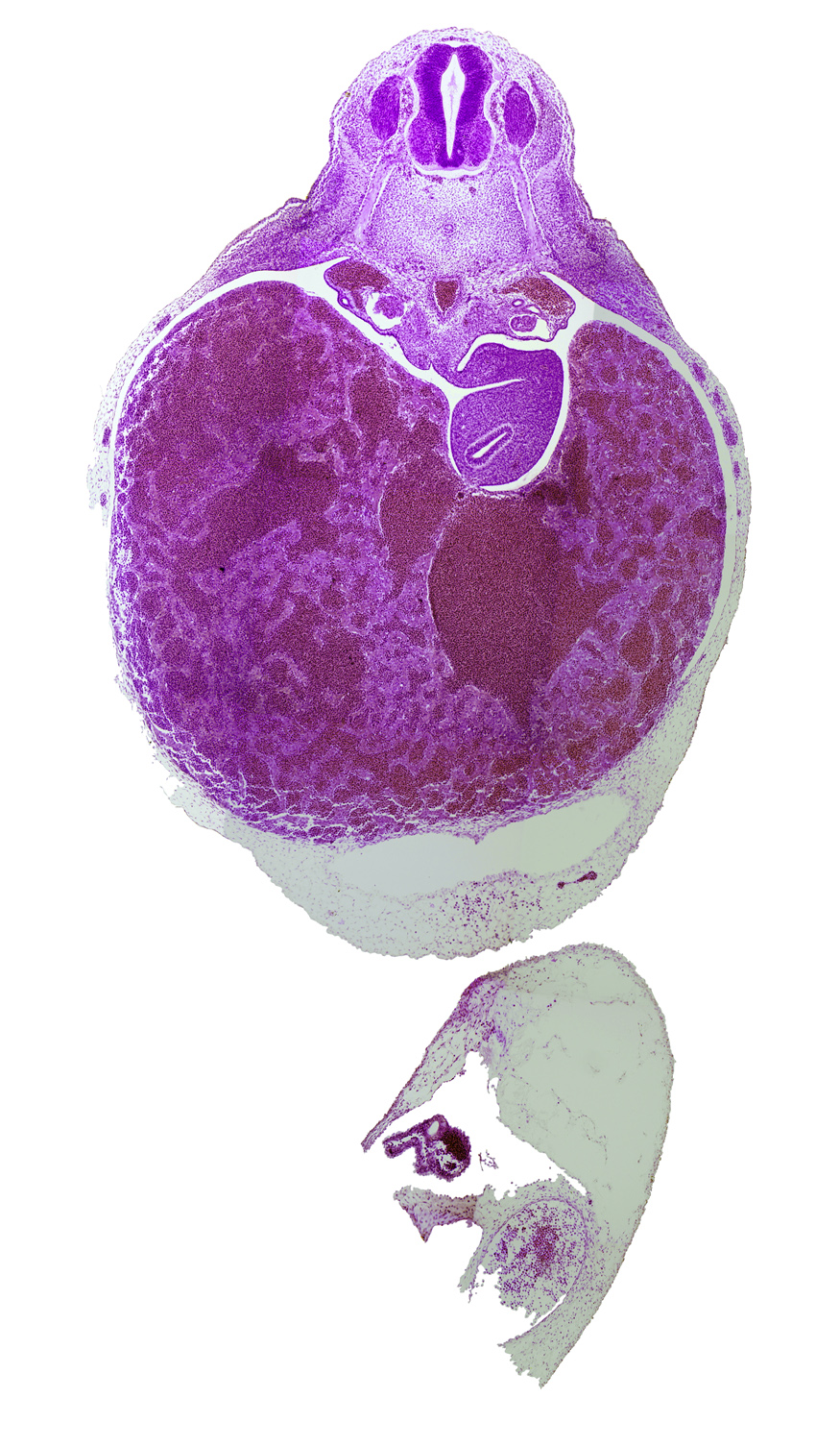 T-3 spinal ganglion, caudal edge of pericardial cavity, ductus venosus, omental foramen, postcardinal vein, splanchnic mesoderm, spleen primordium, stomach endoderm, suprarenal gland primordium