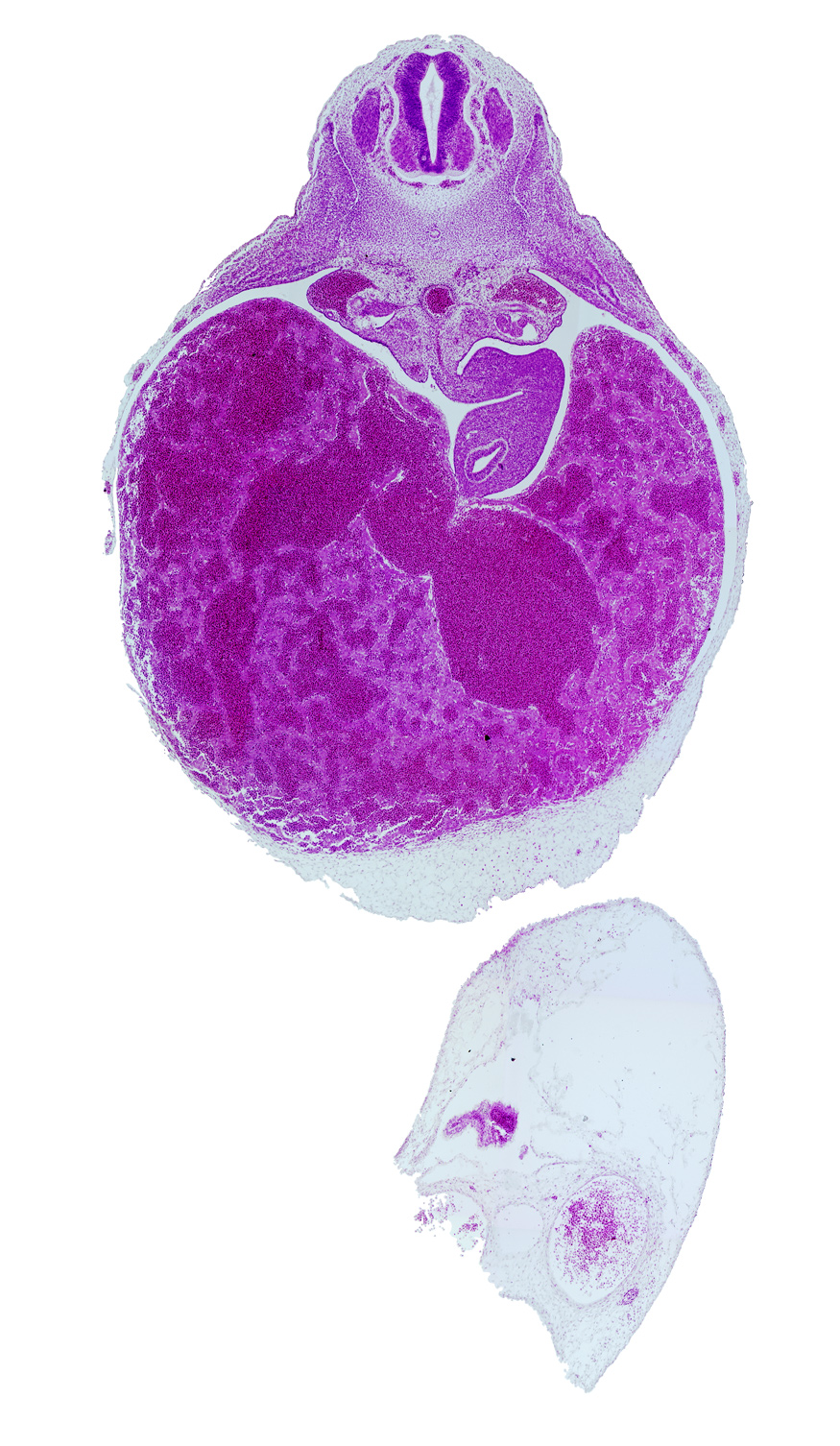 T-3 spinal ganglion, aorta, celiac artery, dorsal mesogastrium, ductus venosus, liver, neural arch blastema, postcardinal vein, stomach, suprarenal gland primordium, vertebral centrum blastema