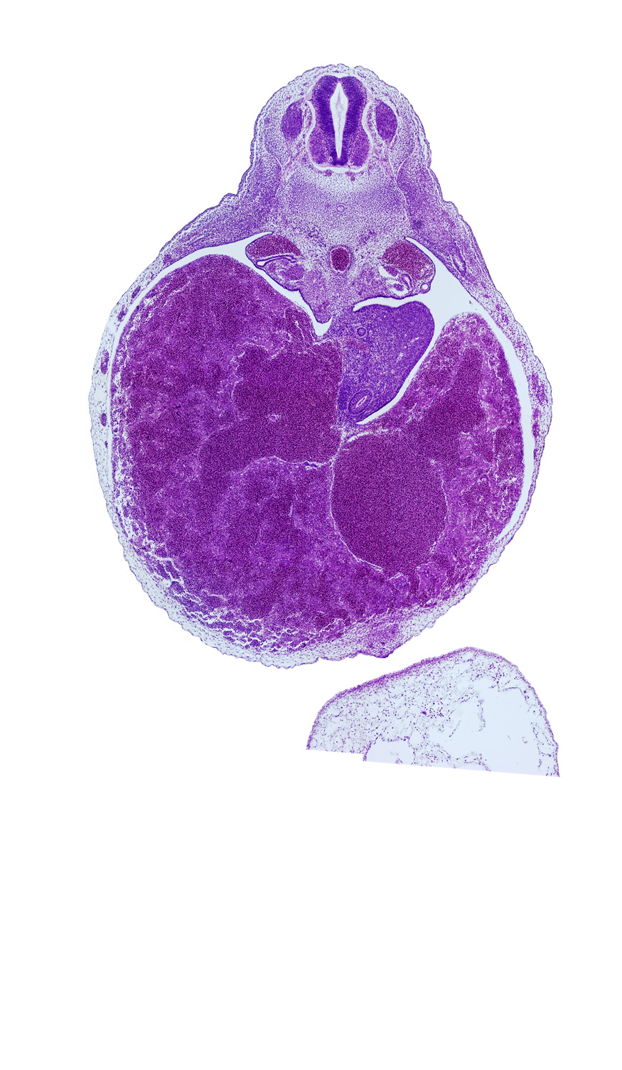 T-4 spinal ganglion, alar plate(s), aorta, basal plate, ductus venosus, duodenum, floor plate, liver, mesonephric duct, mesonephros, peritoneal cavity, postcardinal vein, roof plate, sulcus limitans, ventral body wall