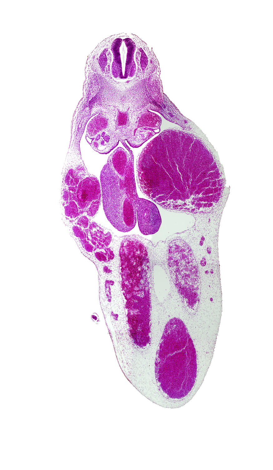 T-8 spinal ganglion, caudal edge of caudal eminence, left umbilical artery, left umbilical vein (congested), mesonephric duct, mesonephric tubule(s), midgut, postcardinal vein, right umbilical artery, right umbilical vein, superior mesenteric artery, umbilical vein