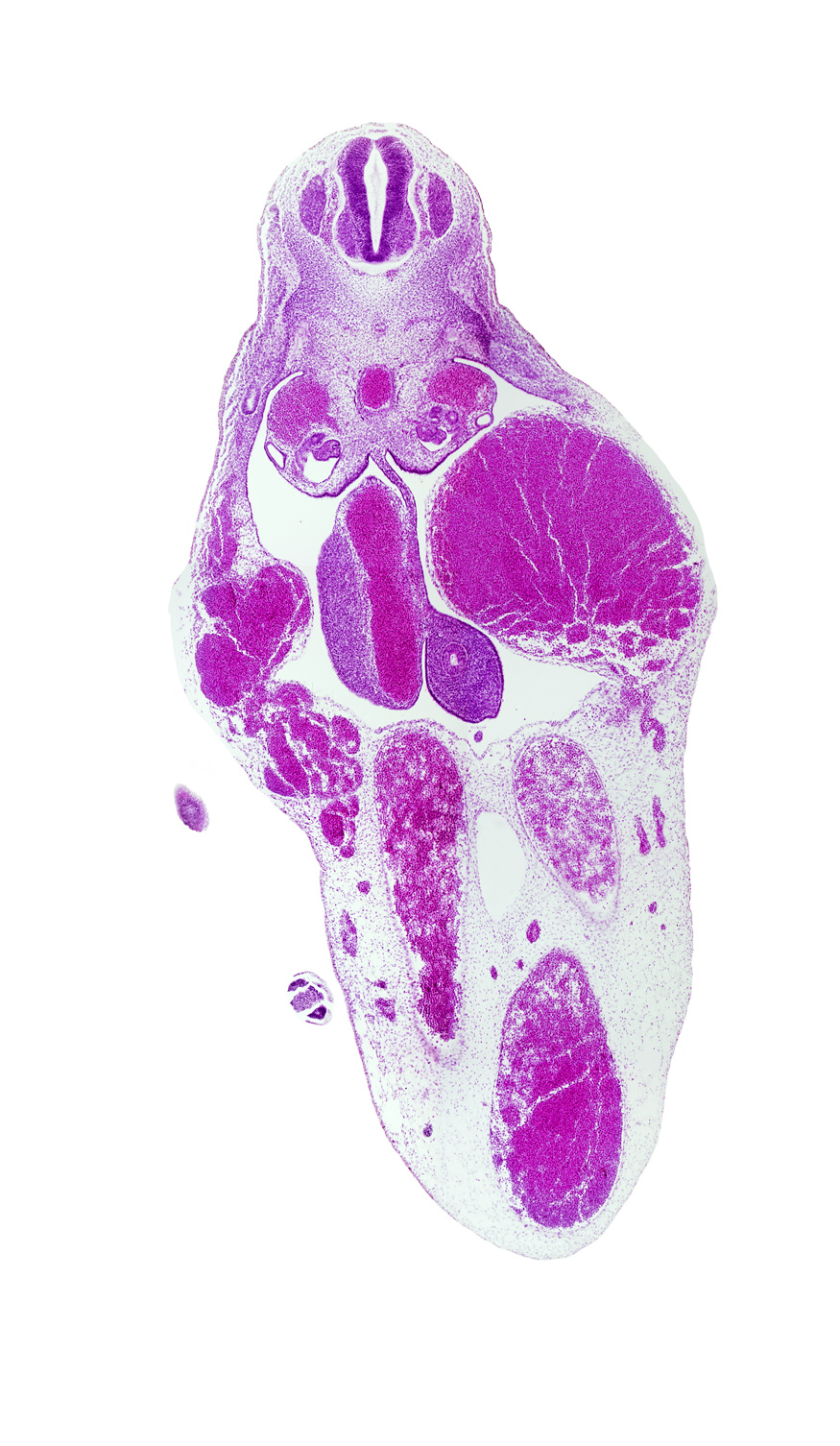 T-8 spinal ganglion, allantois, aorta, caudal edge of foot plate, caudal eminence, left umbilical artery, left umbilical vein, mesonephric duct, midgut, right umbilical artery, superior mesenteric artery, umbilical vein