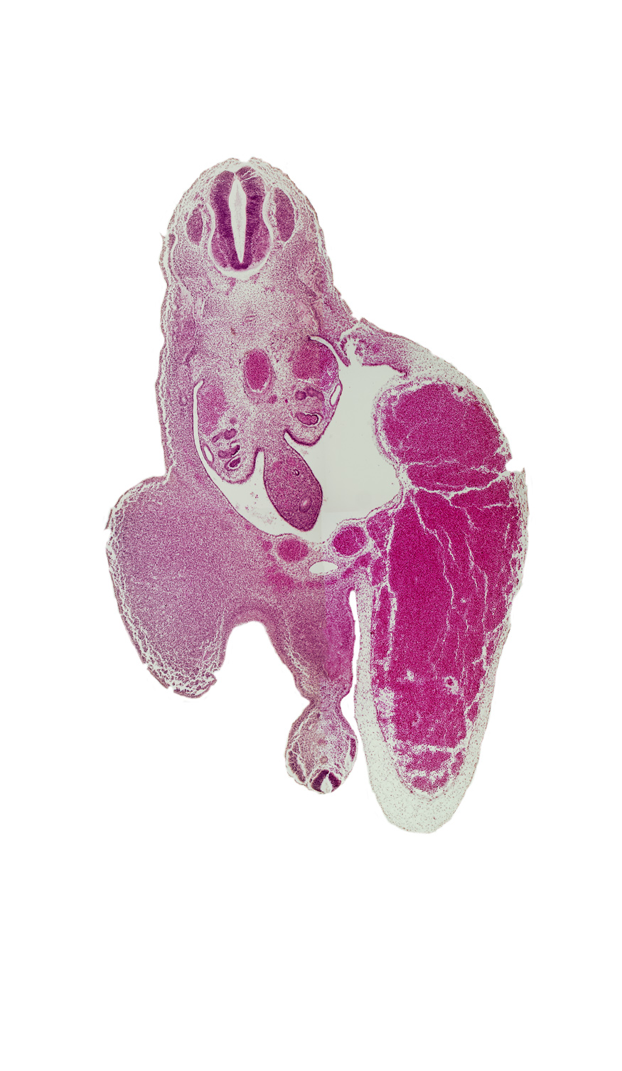 T-10 spinal ganglion, aorta, caudal eminence, gonadal ridge, hindgut, junction of allantois and primordial urogenital sinus, left umbilical artery, left umbilical vein (congested), lower limb (proximal part), mesonephric duct, peritoneal cavity